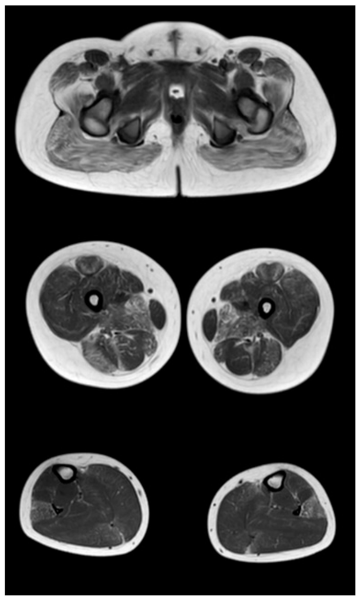 Tomography 08 00076 g004