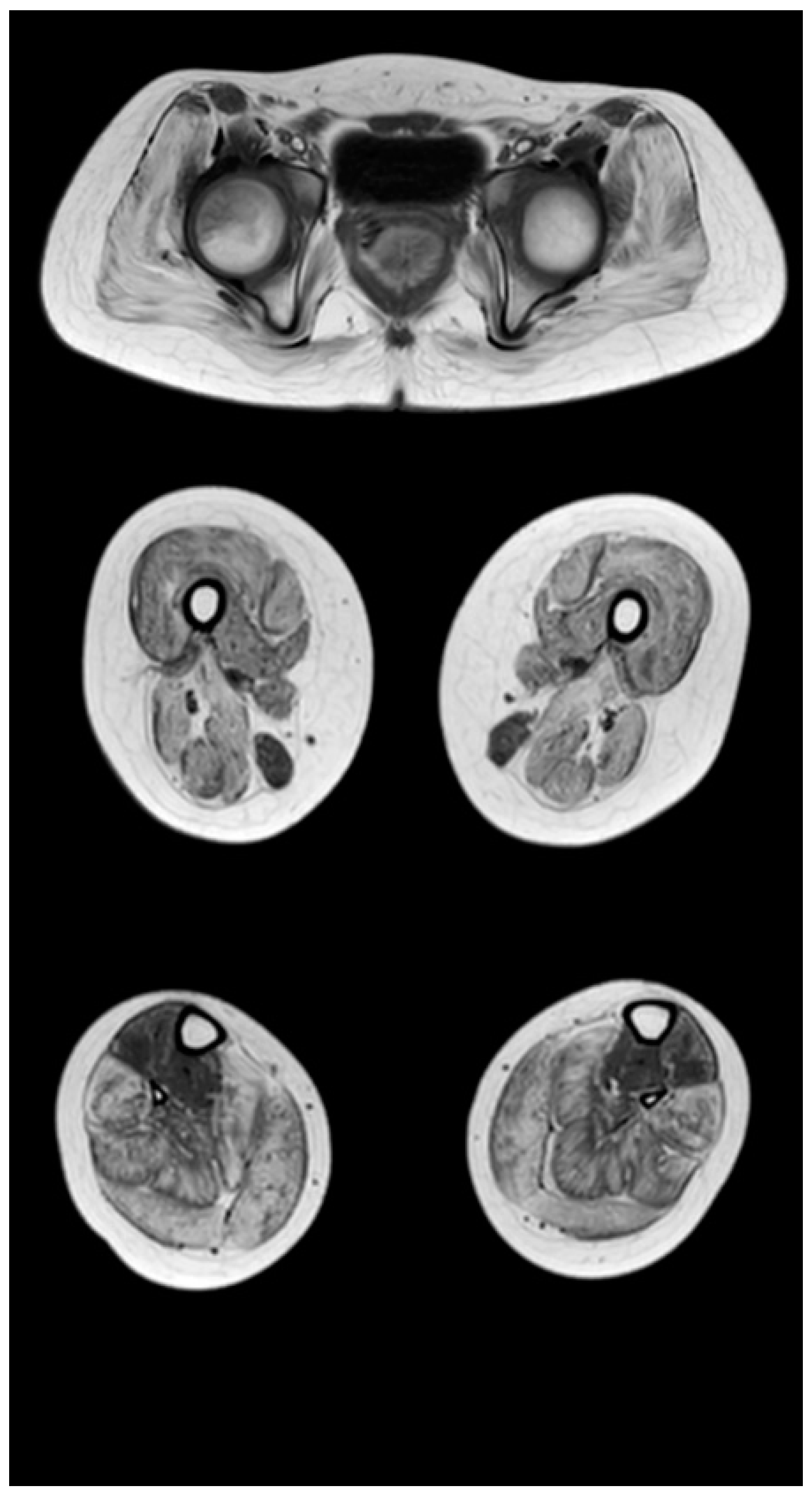 Tomography 08 00076 g005