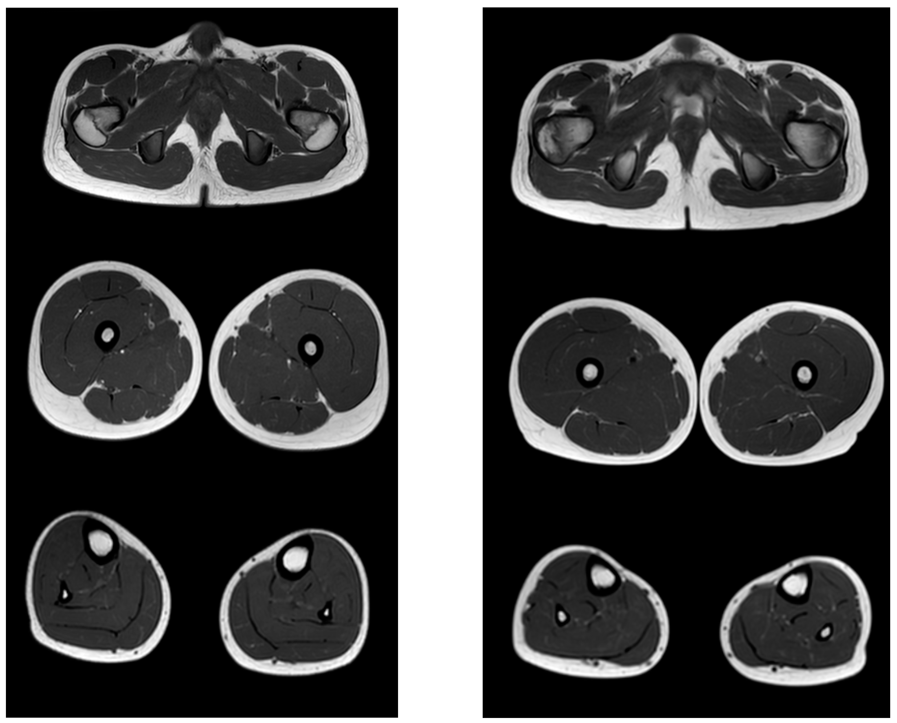 Tomography 08 00076 g006