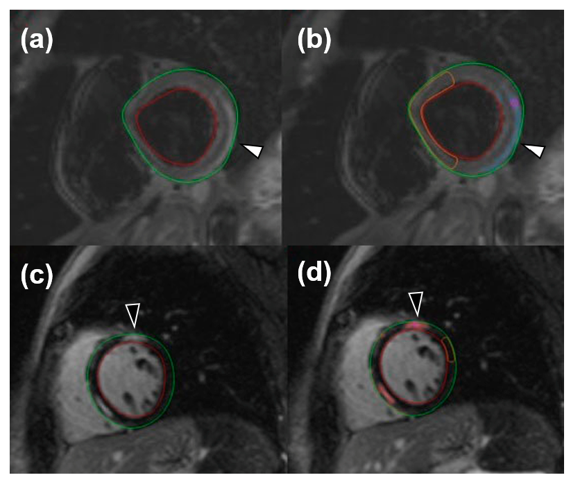 Tomography 08 00078 g001