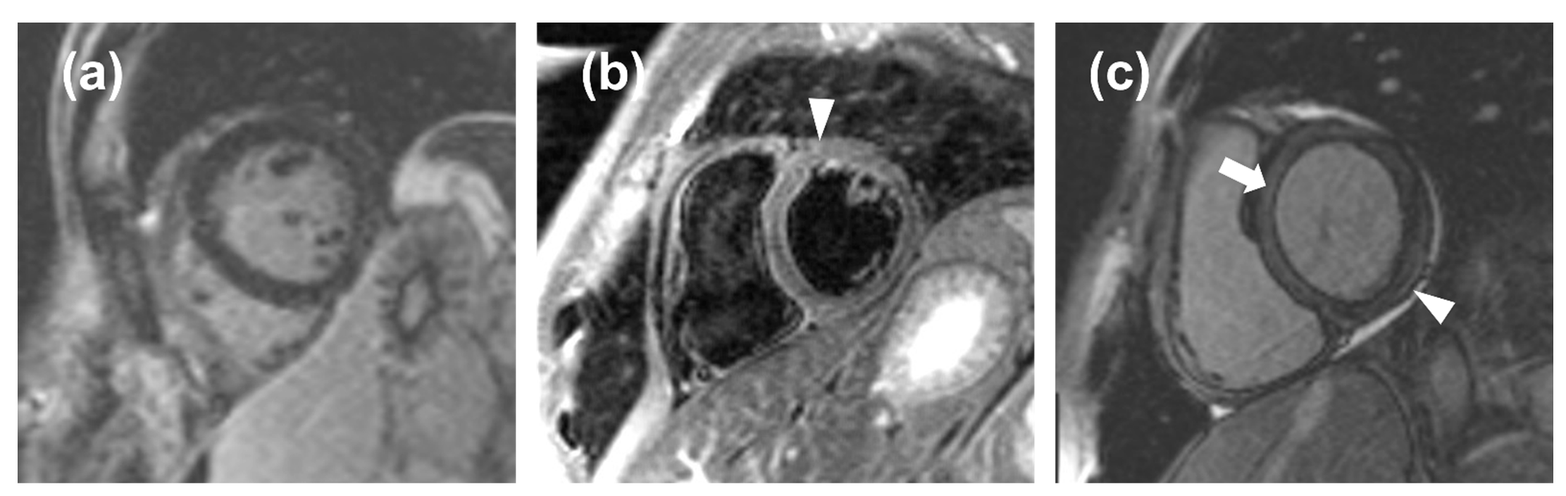 Tomography 08 00078 g005