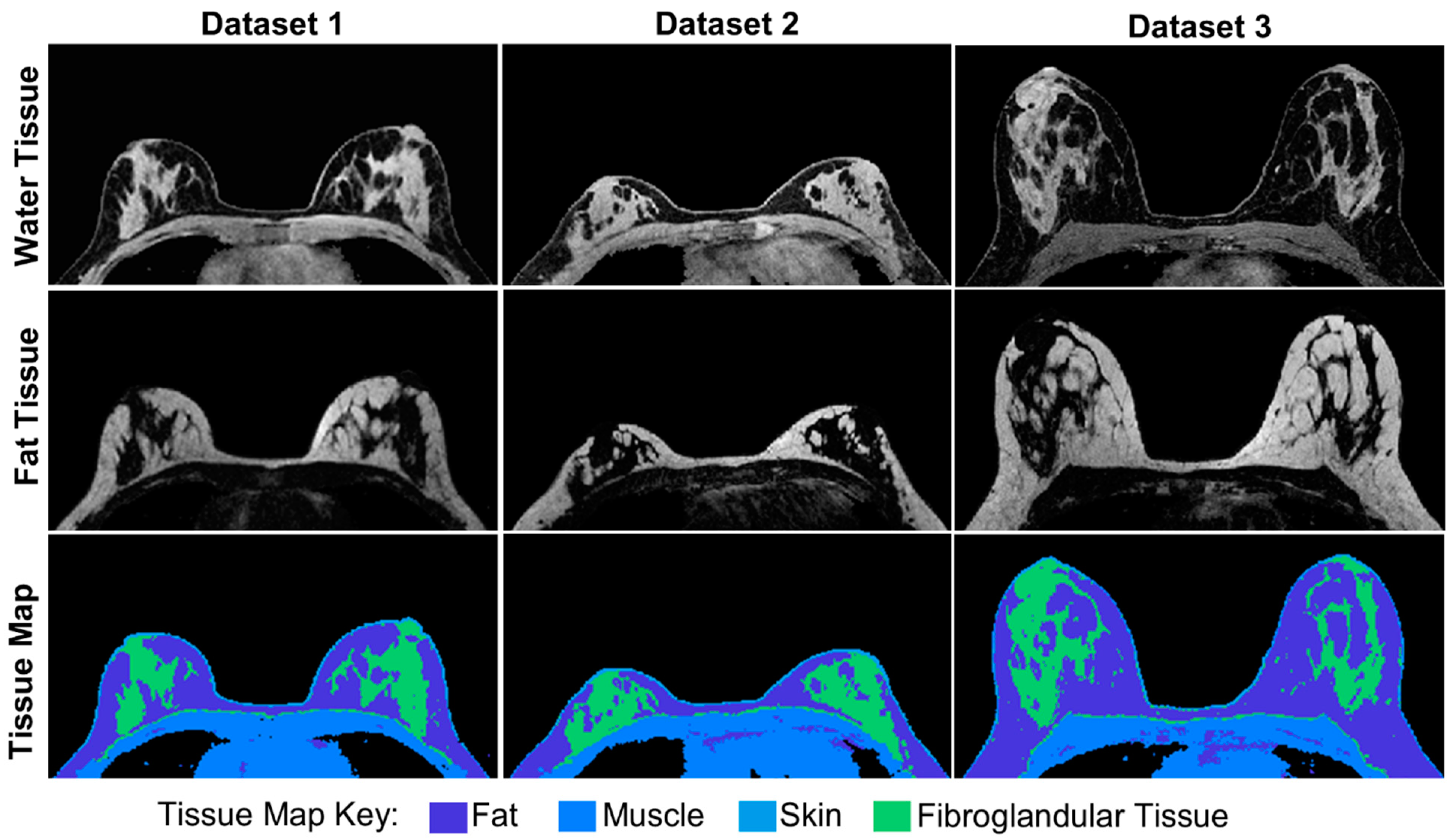 Tomography 08 00081 g003