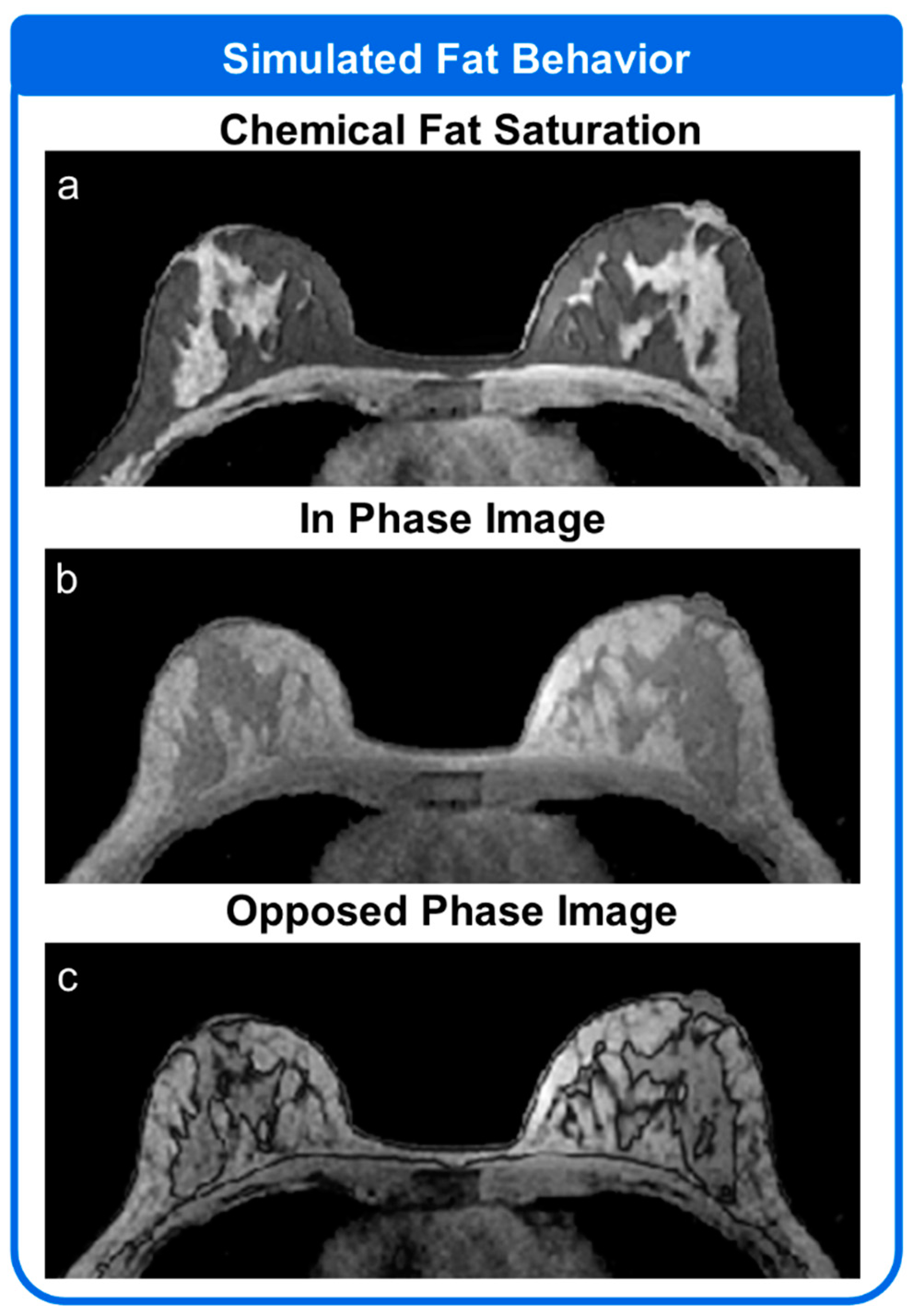 Tomography 08 00081 g006