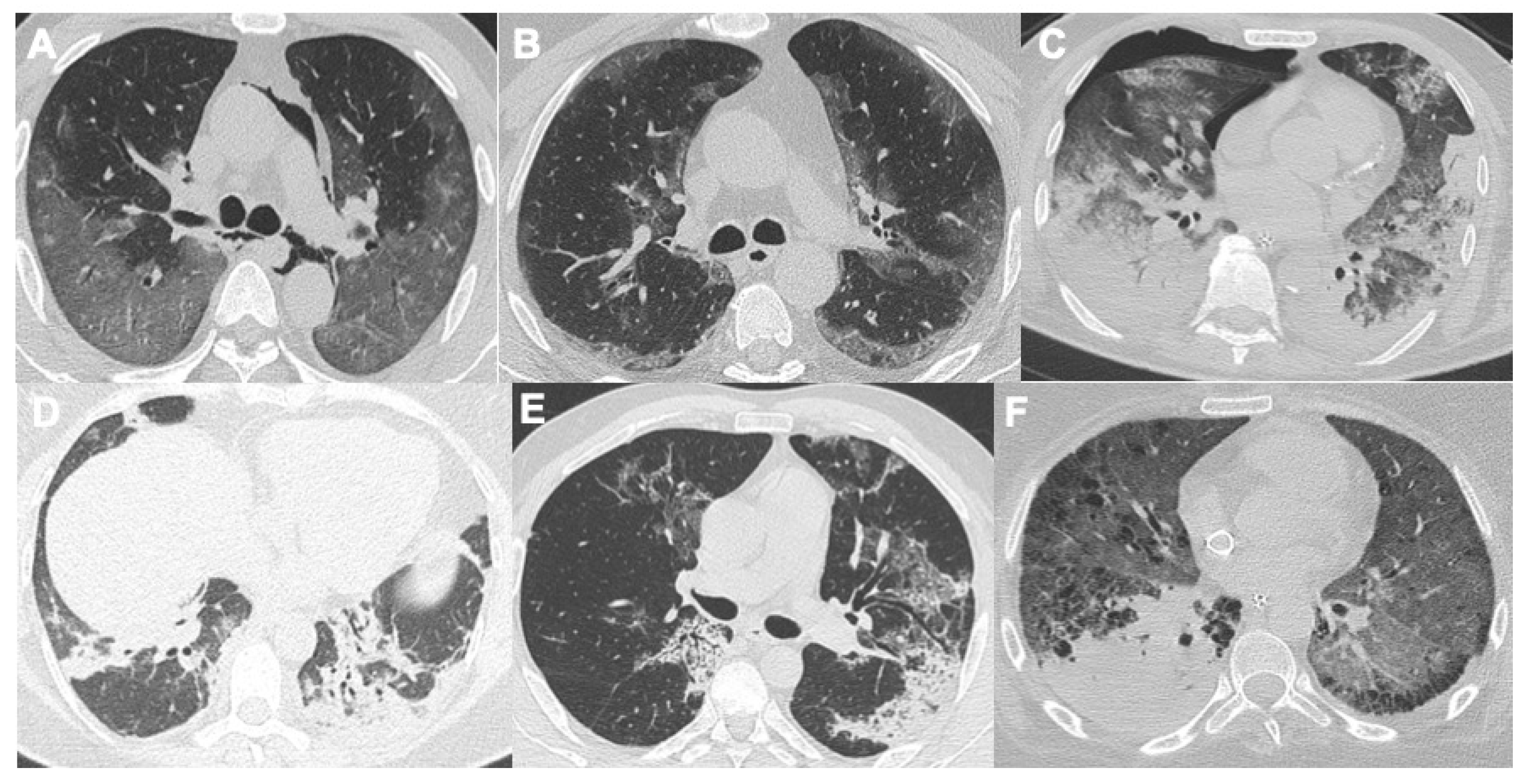 Tomography 08 00084 g001