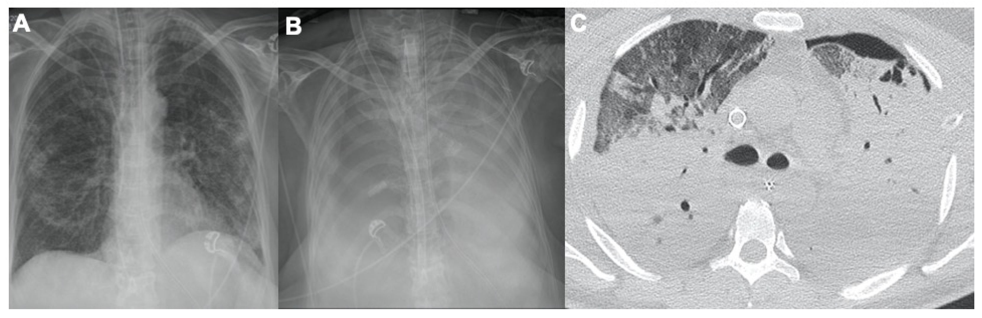 Tomography 08 00084 g002