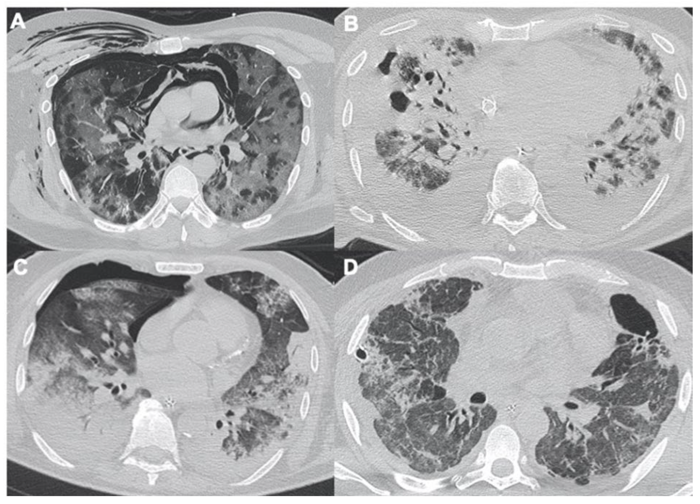 Tomography 08 00084 g003