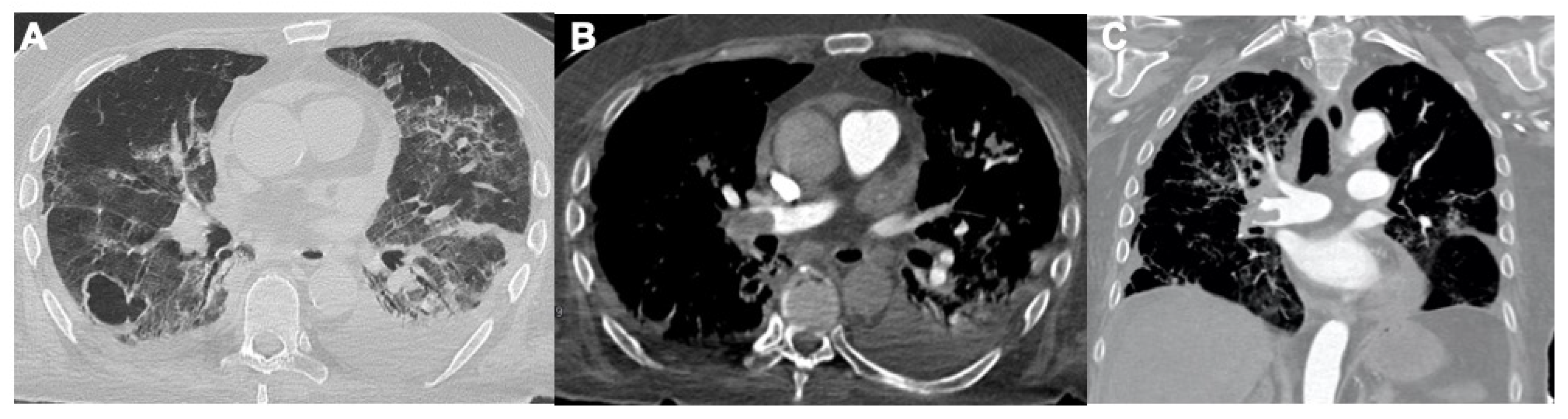 Tomography 08 00084 g004