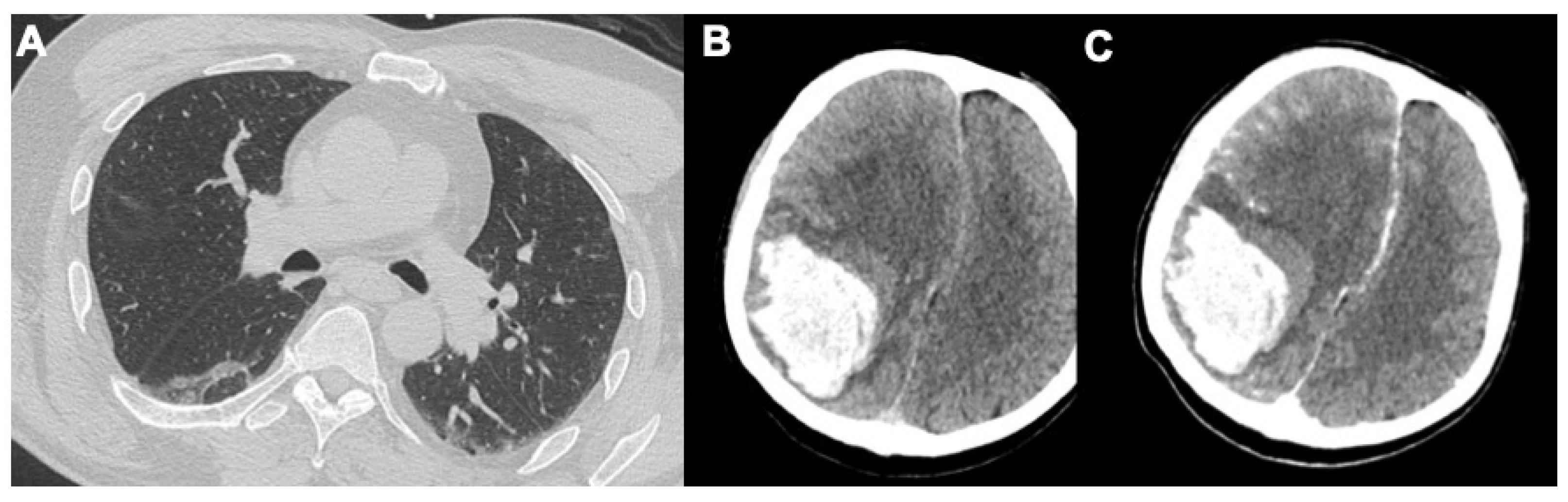 Tomography 08 00084 g006