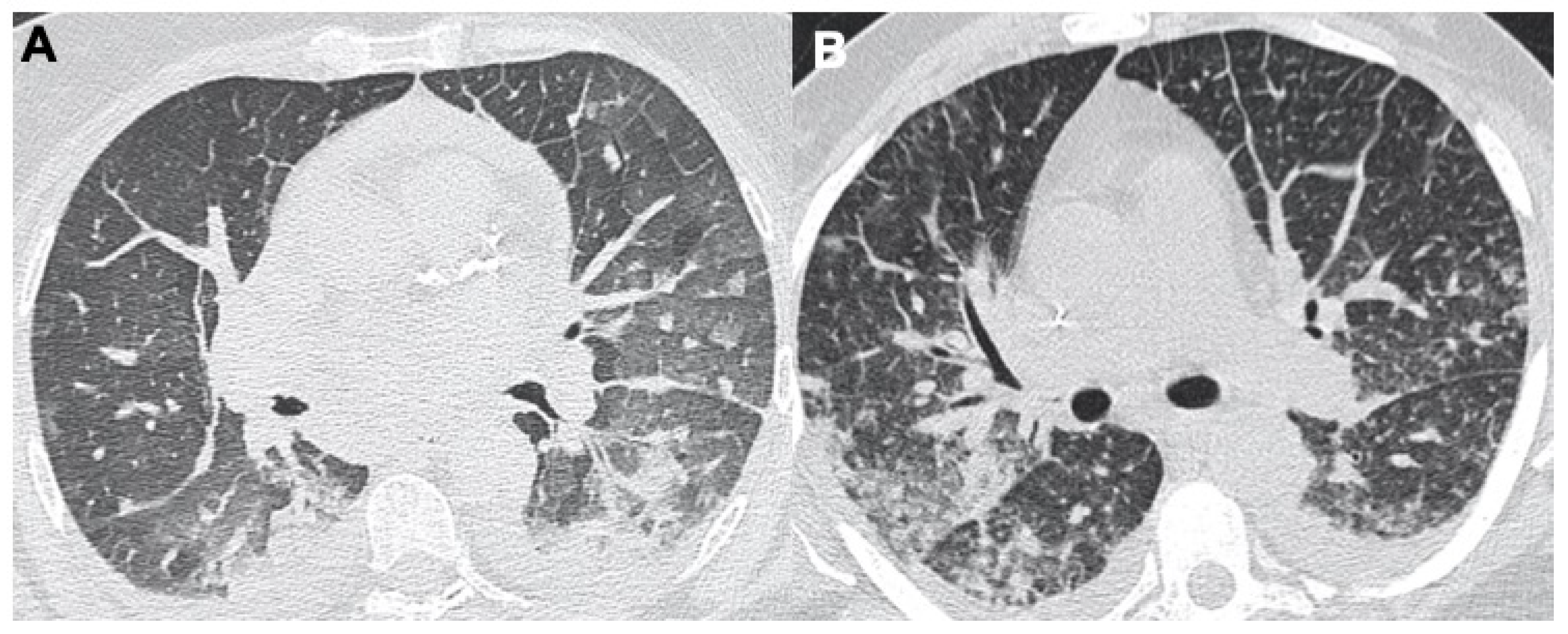 Tomography 08 00084 g007