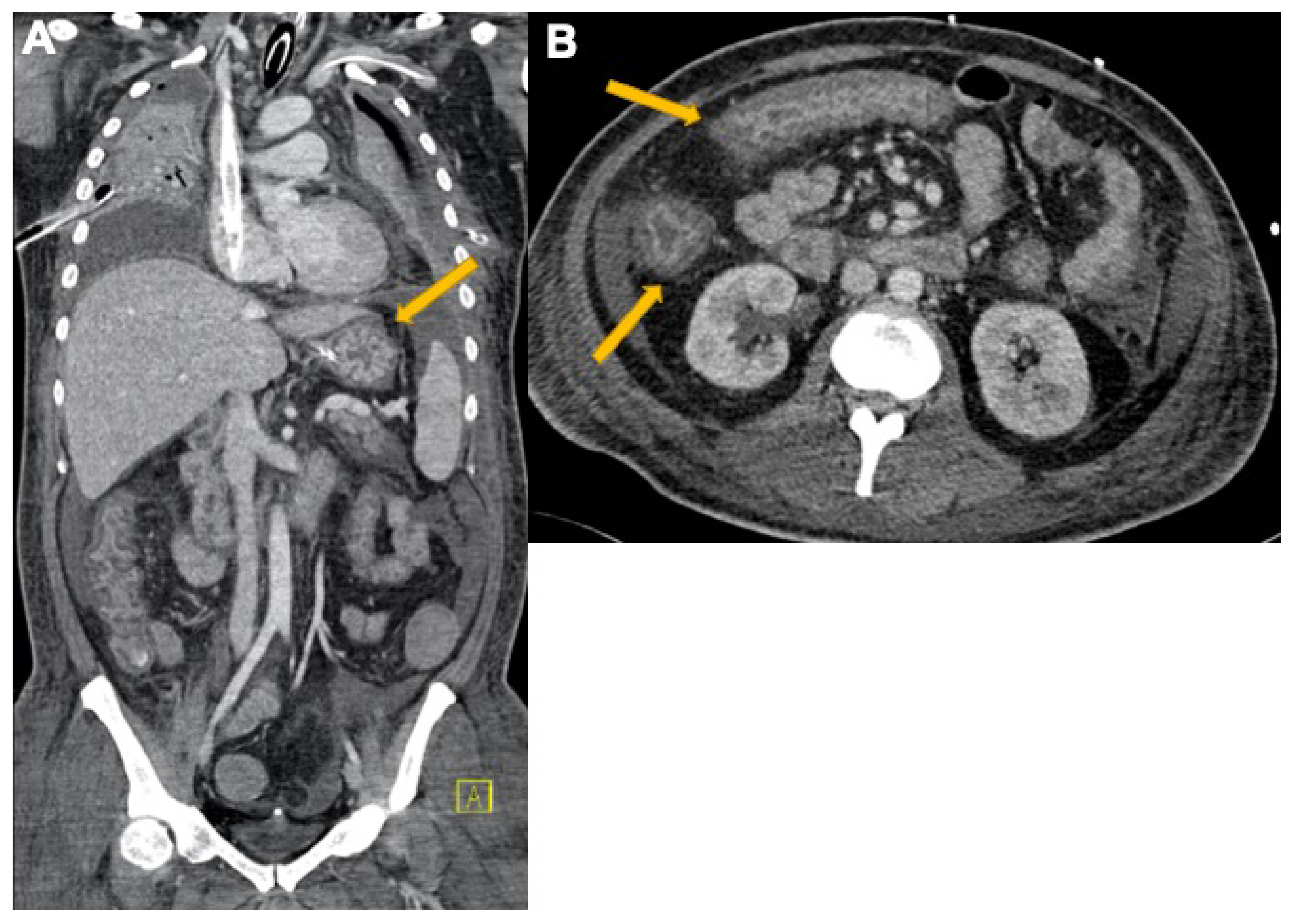 Tomography 08 00084 g008