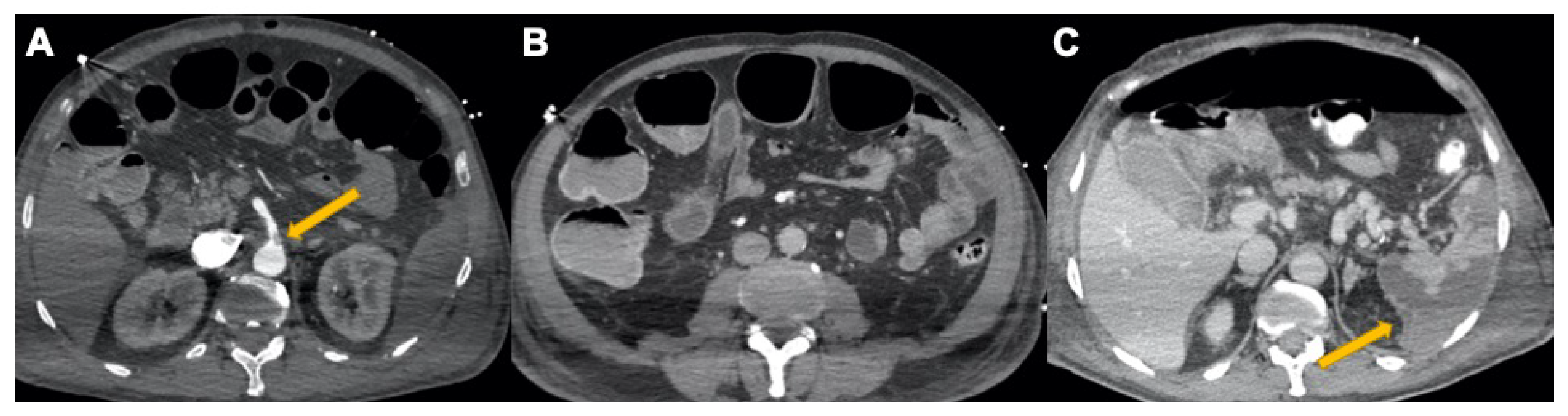 Tomography 08 00084 g009