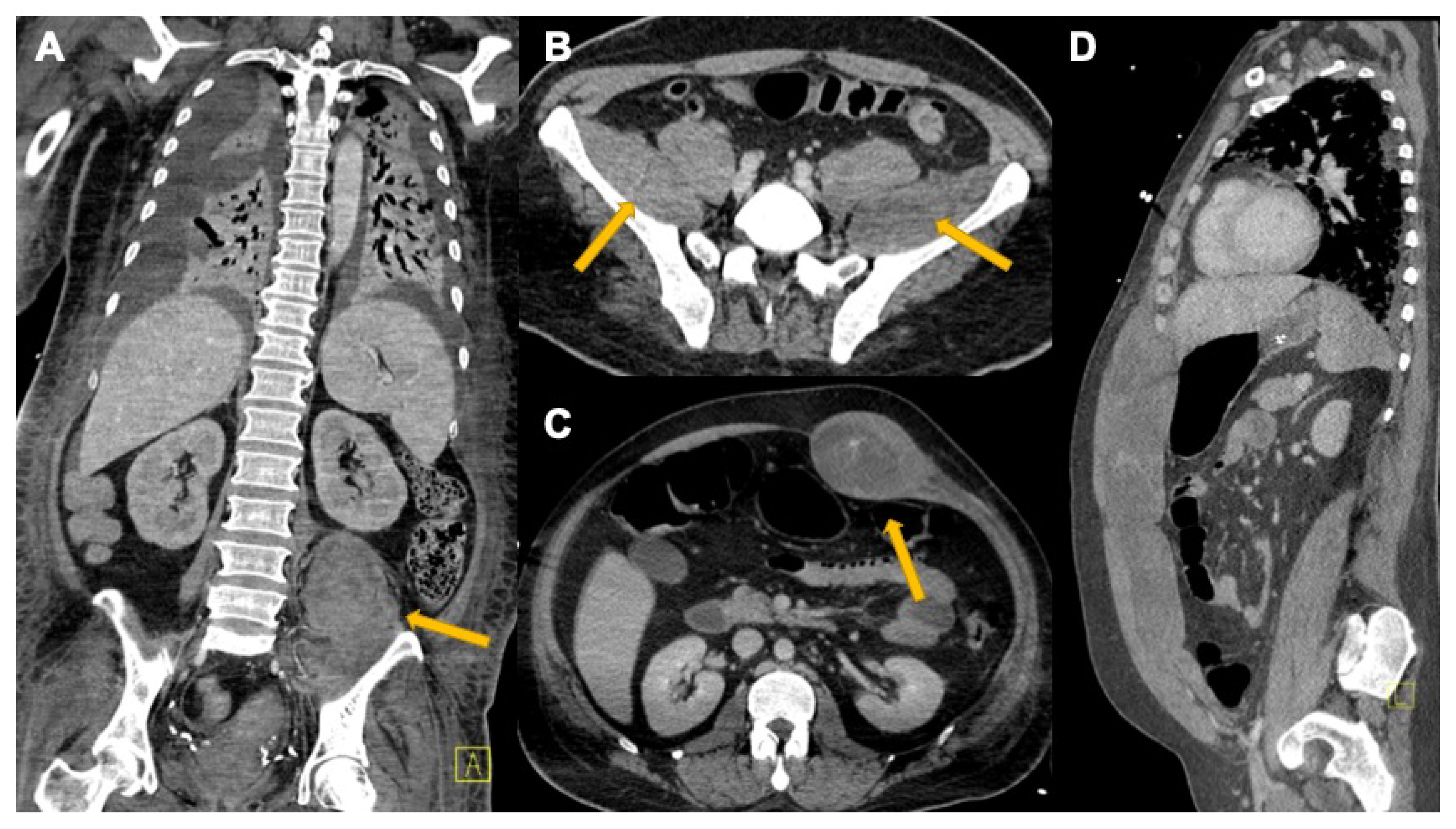 Tomography 08 00084 g011