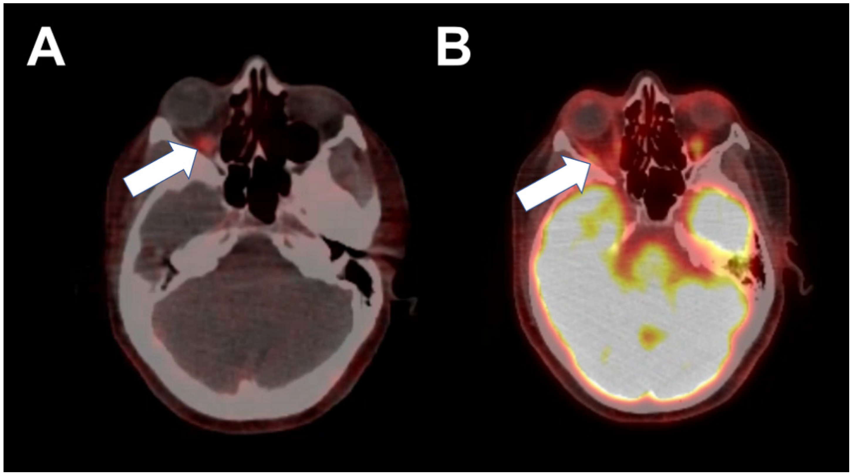 Tomography 08 00086 g001