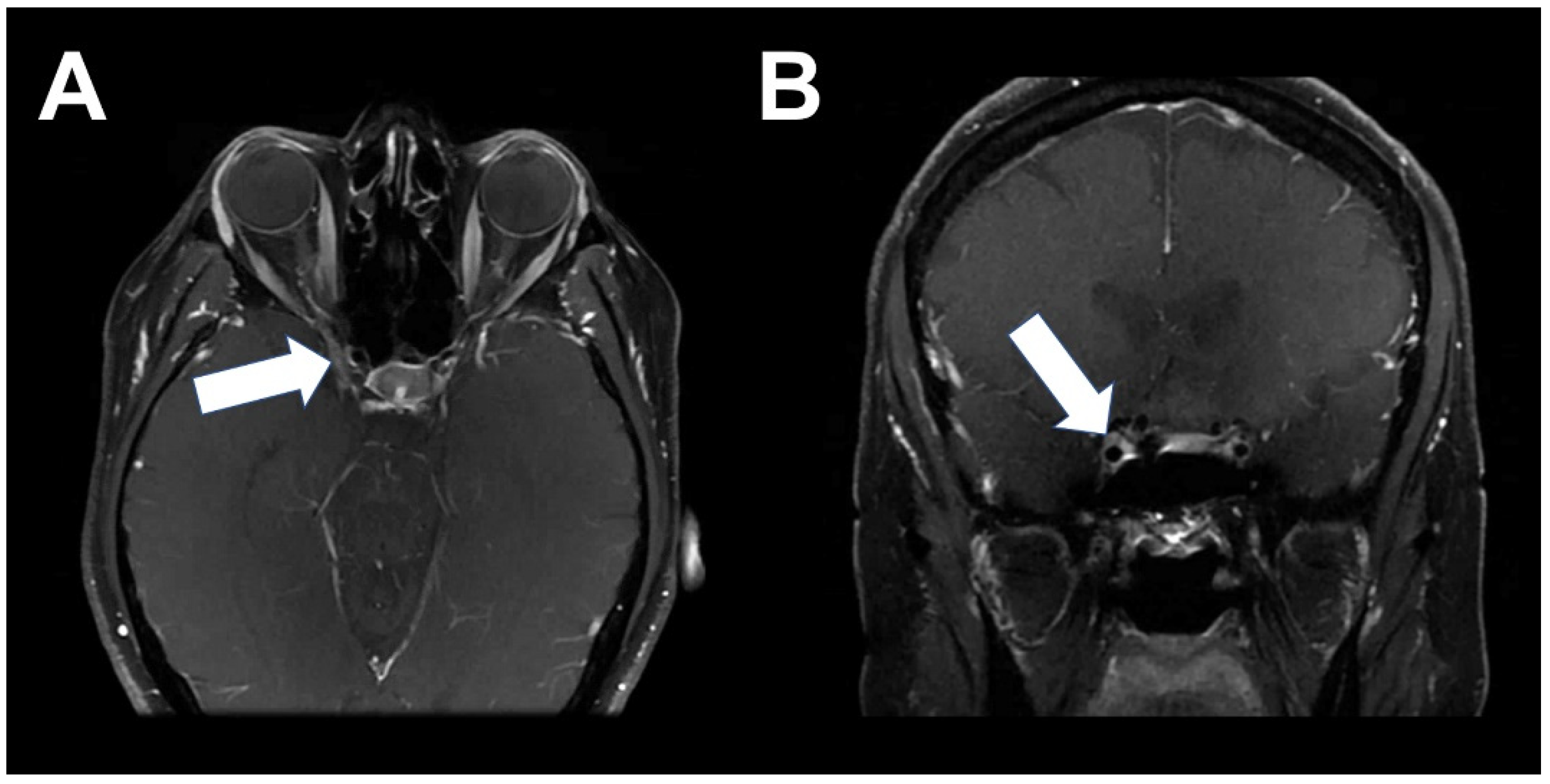 Tomography 08 00086 g002