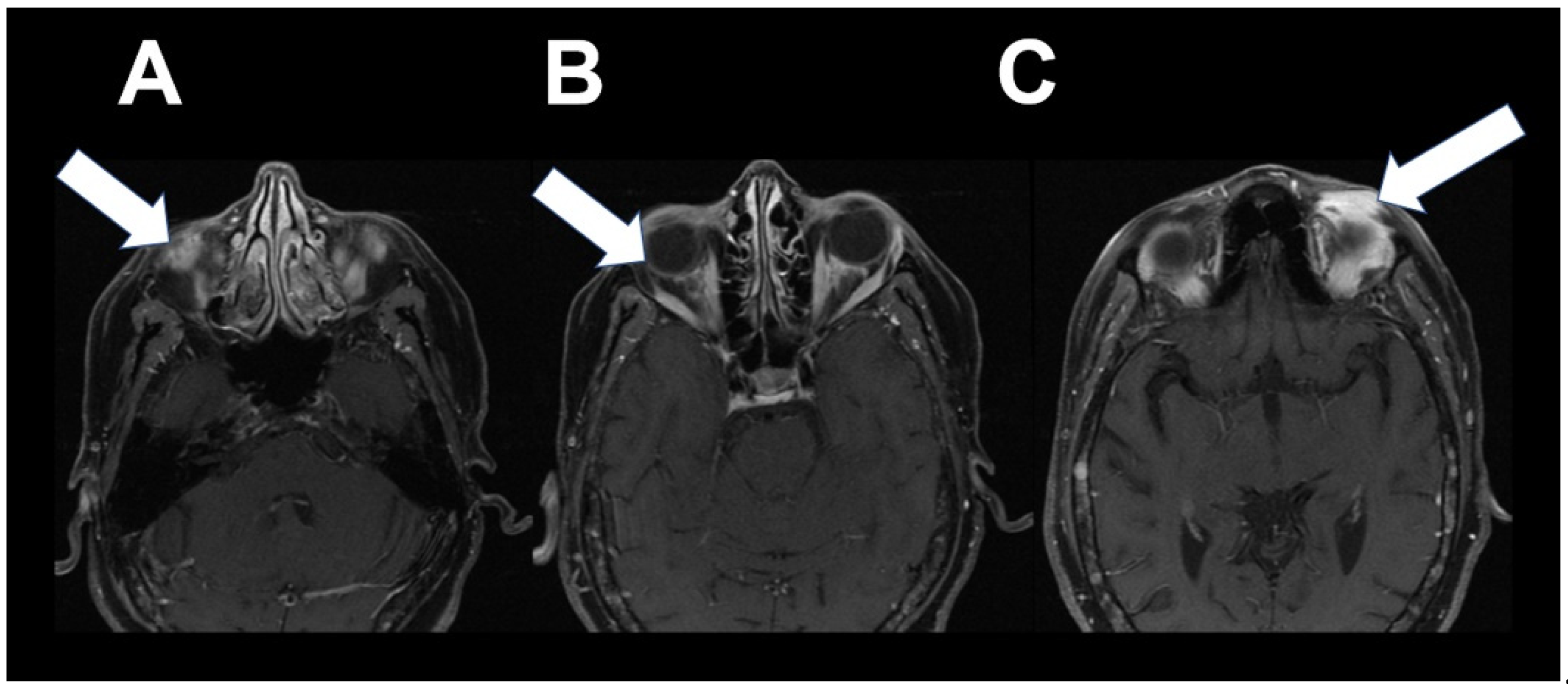 Tomography 08 00086 g004