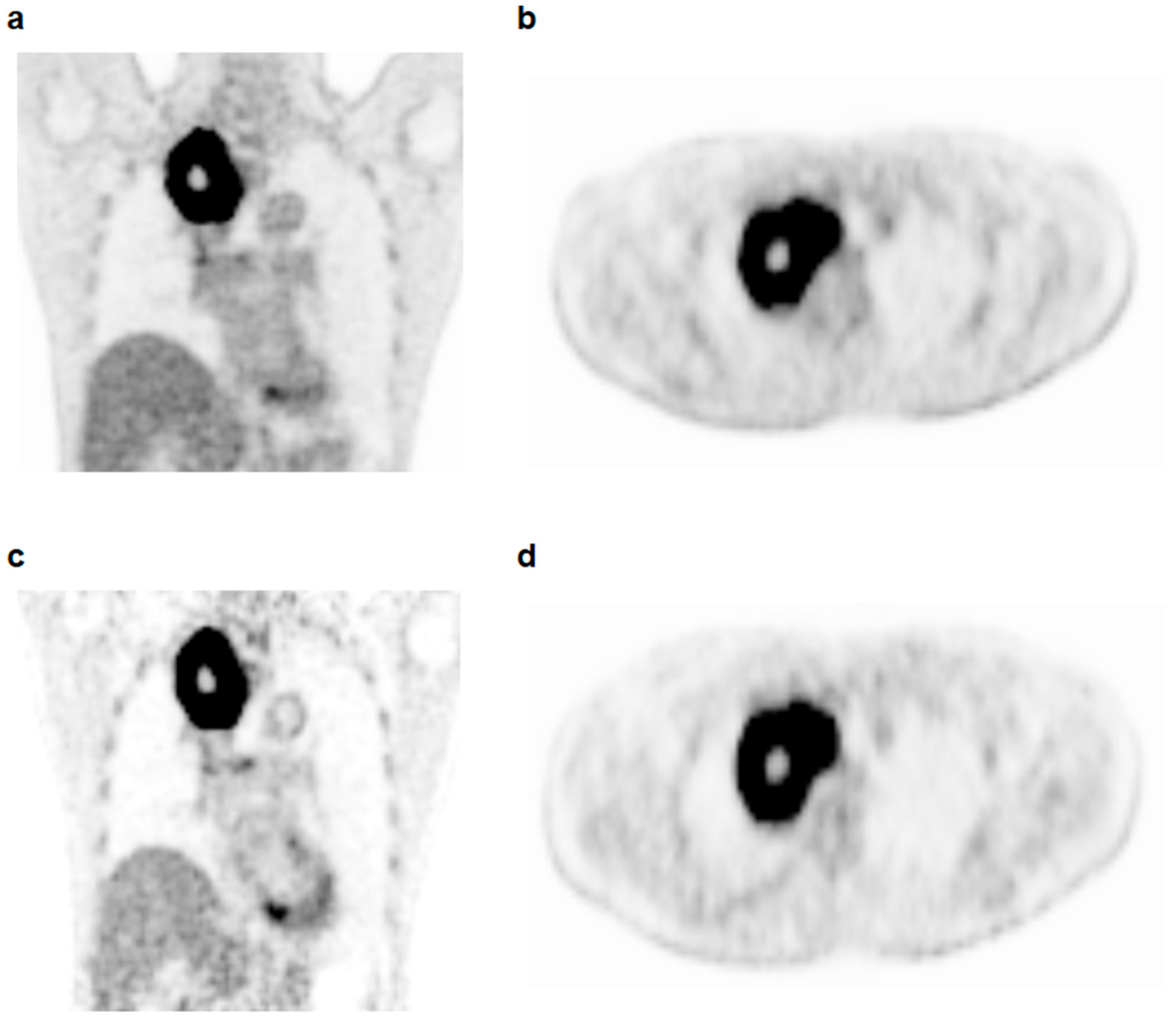 Tomography 08 00087 g001 Tomography 08 00087 g001