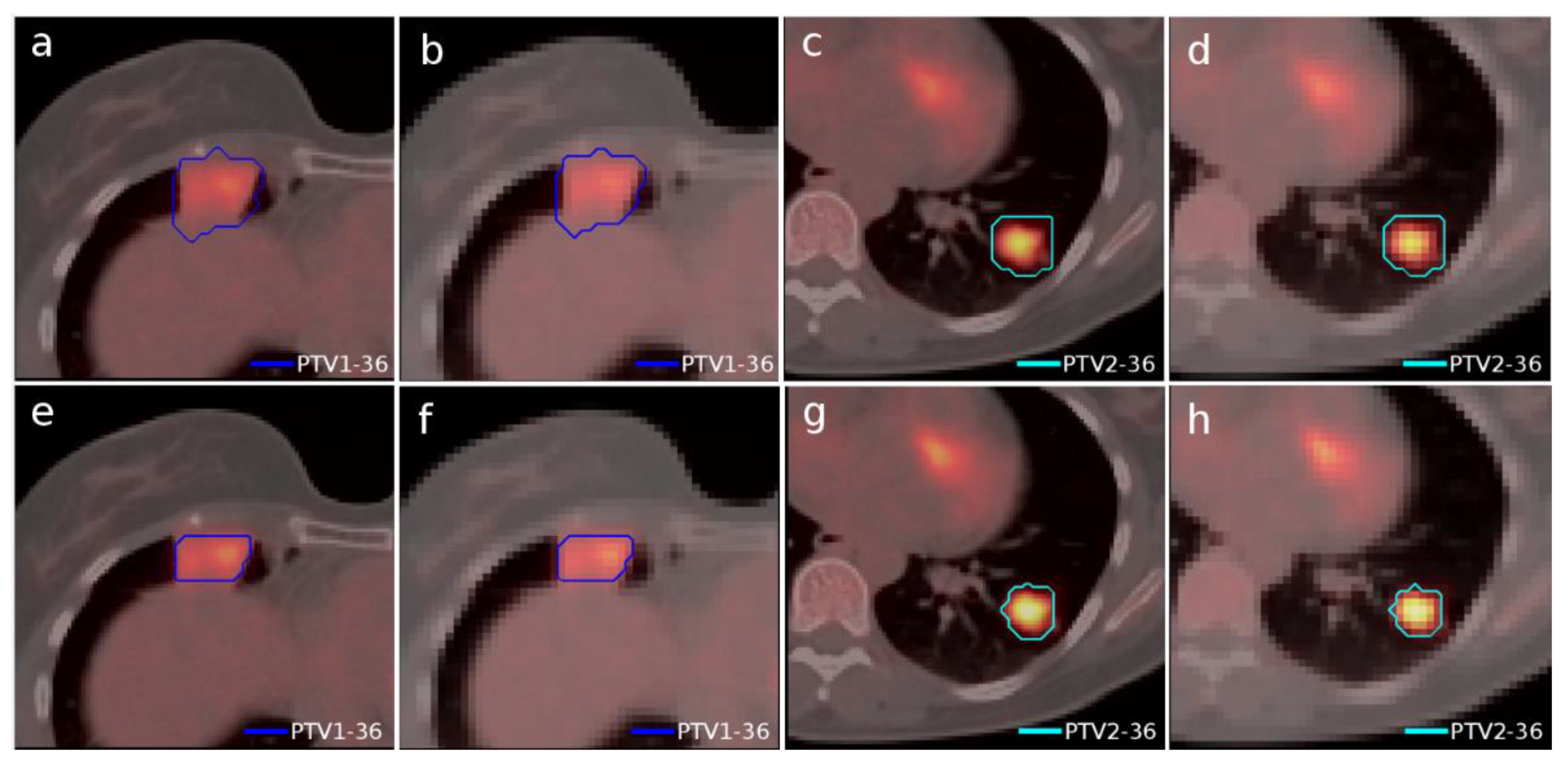 Tomography 08 00090 g004 Tomography 08 00090 g004