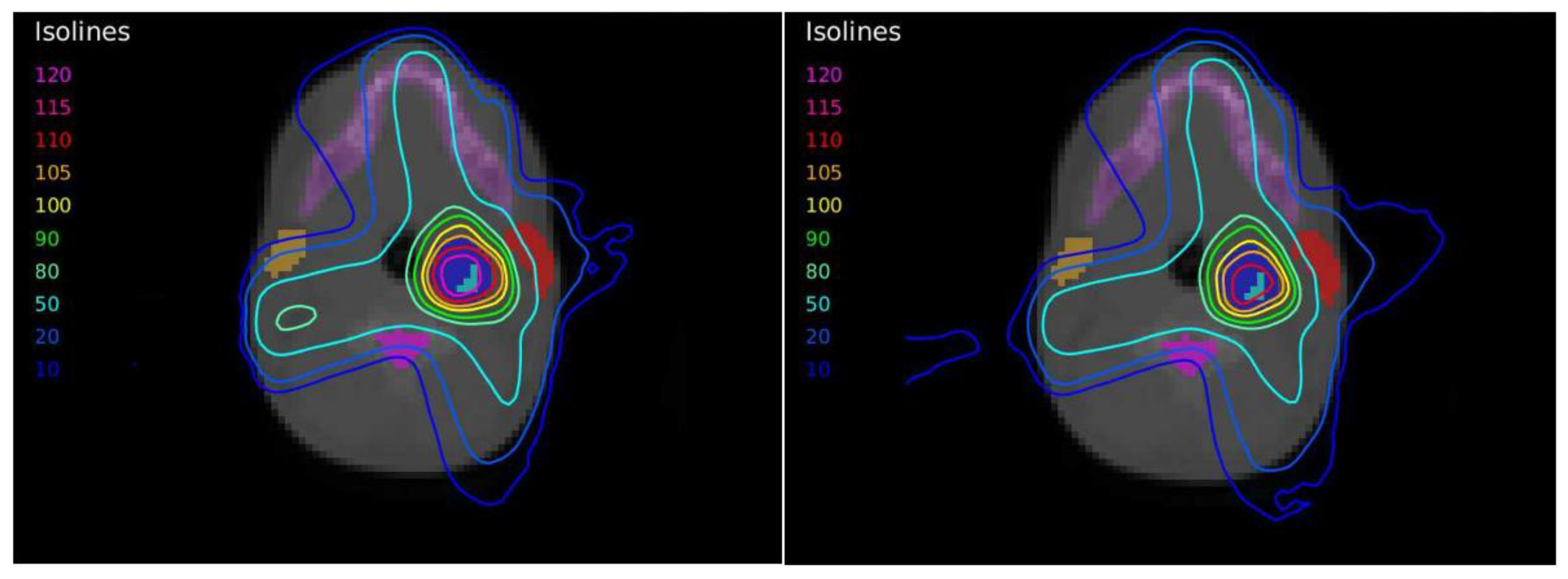 Tomography 08 00090 g005 Tomography 08 00090 g005