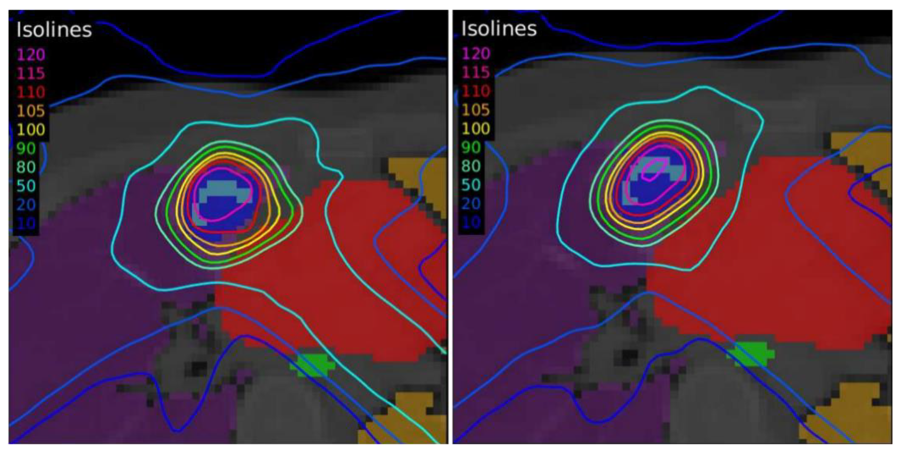 Tomography 08 00090 g007 Tomography 08 00090 g007