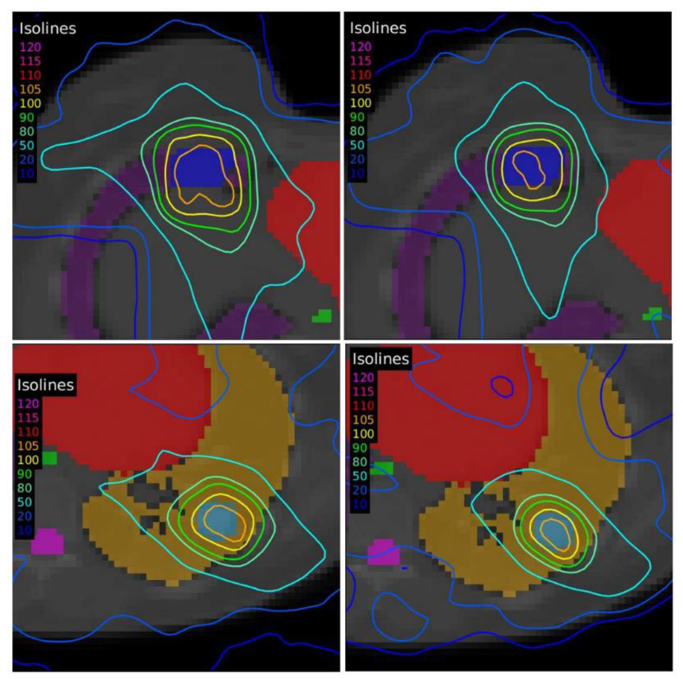 Tomography 08 00090 g009 Tomography 08 00090 g009