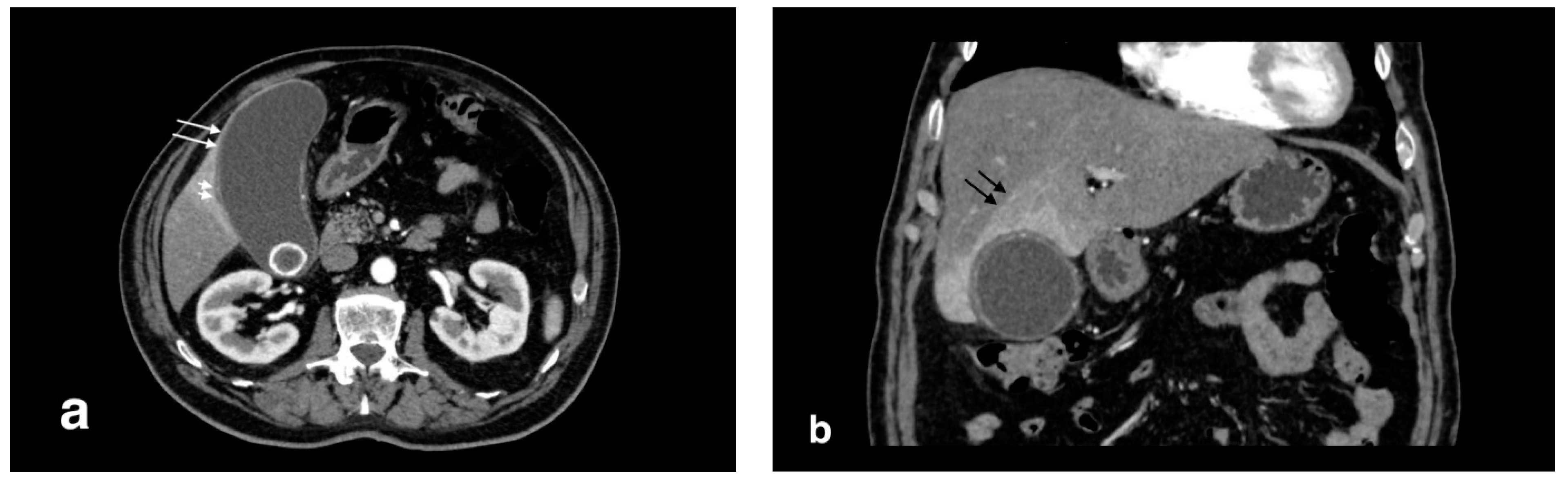 Tomography 08 00095 g001