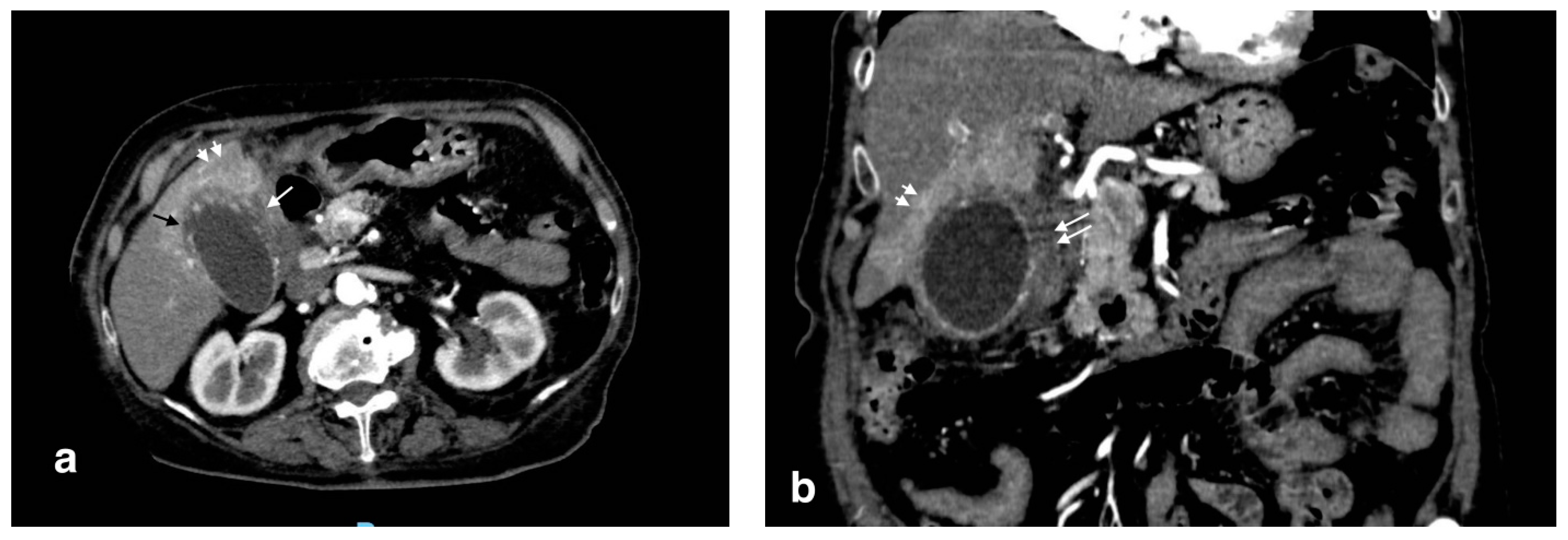 Tomography 08 00095 g002