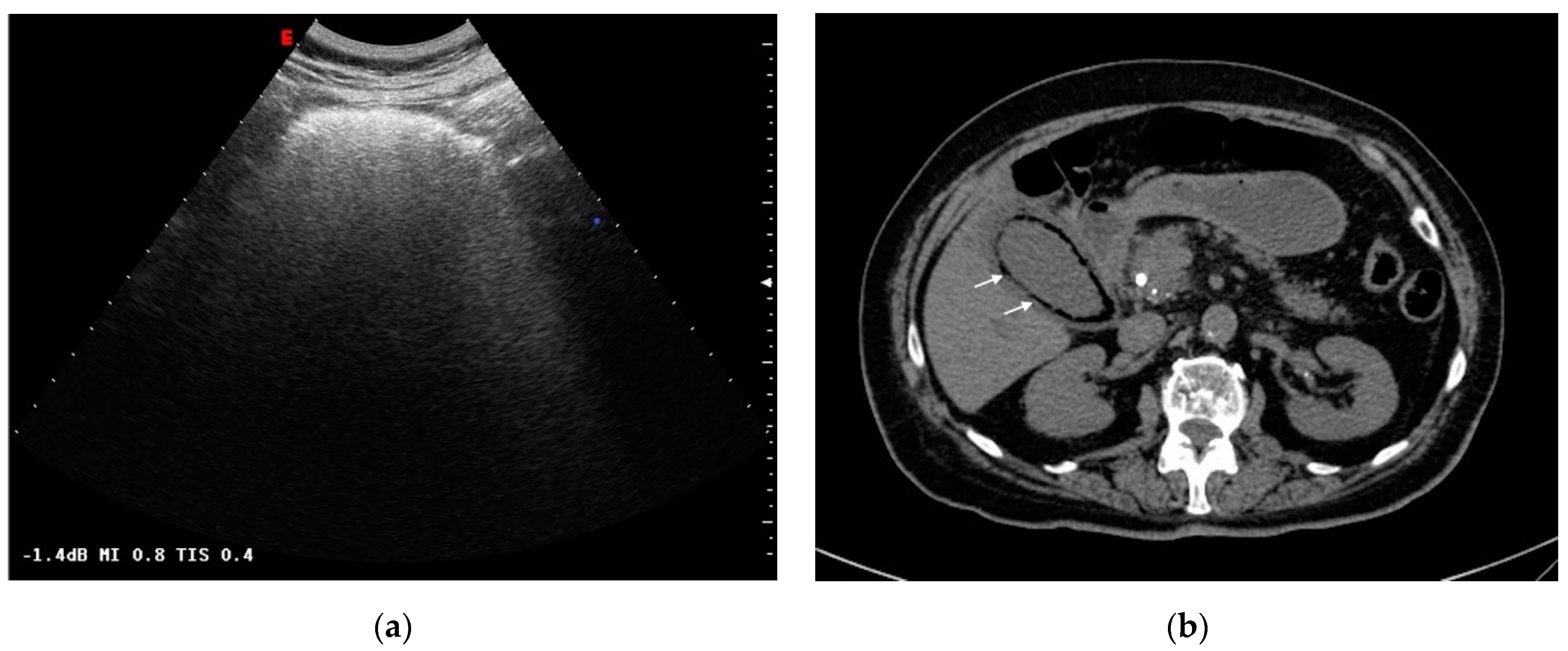 Tomography 08 00095 g003