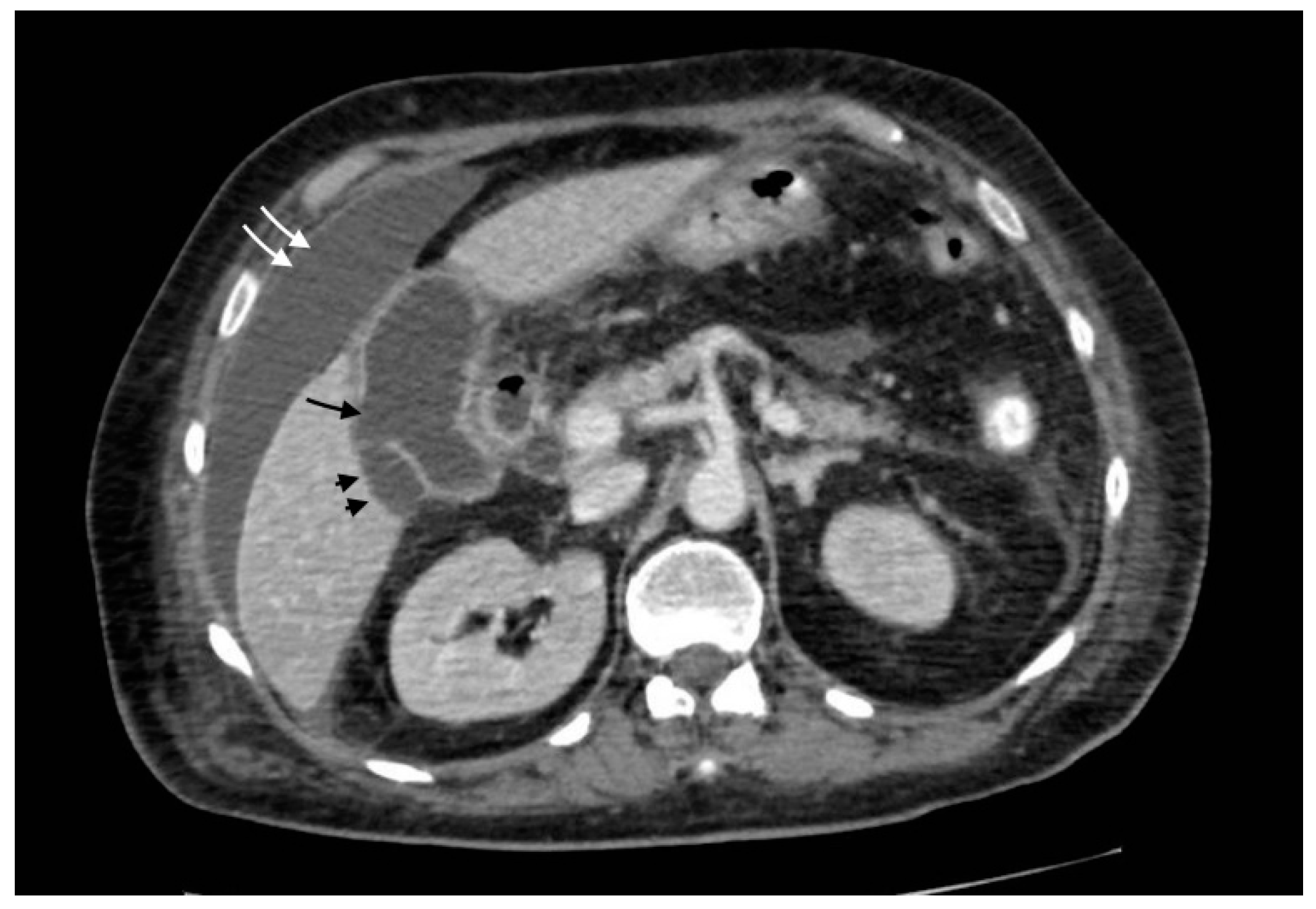 Tomography 08 00095 g004