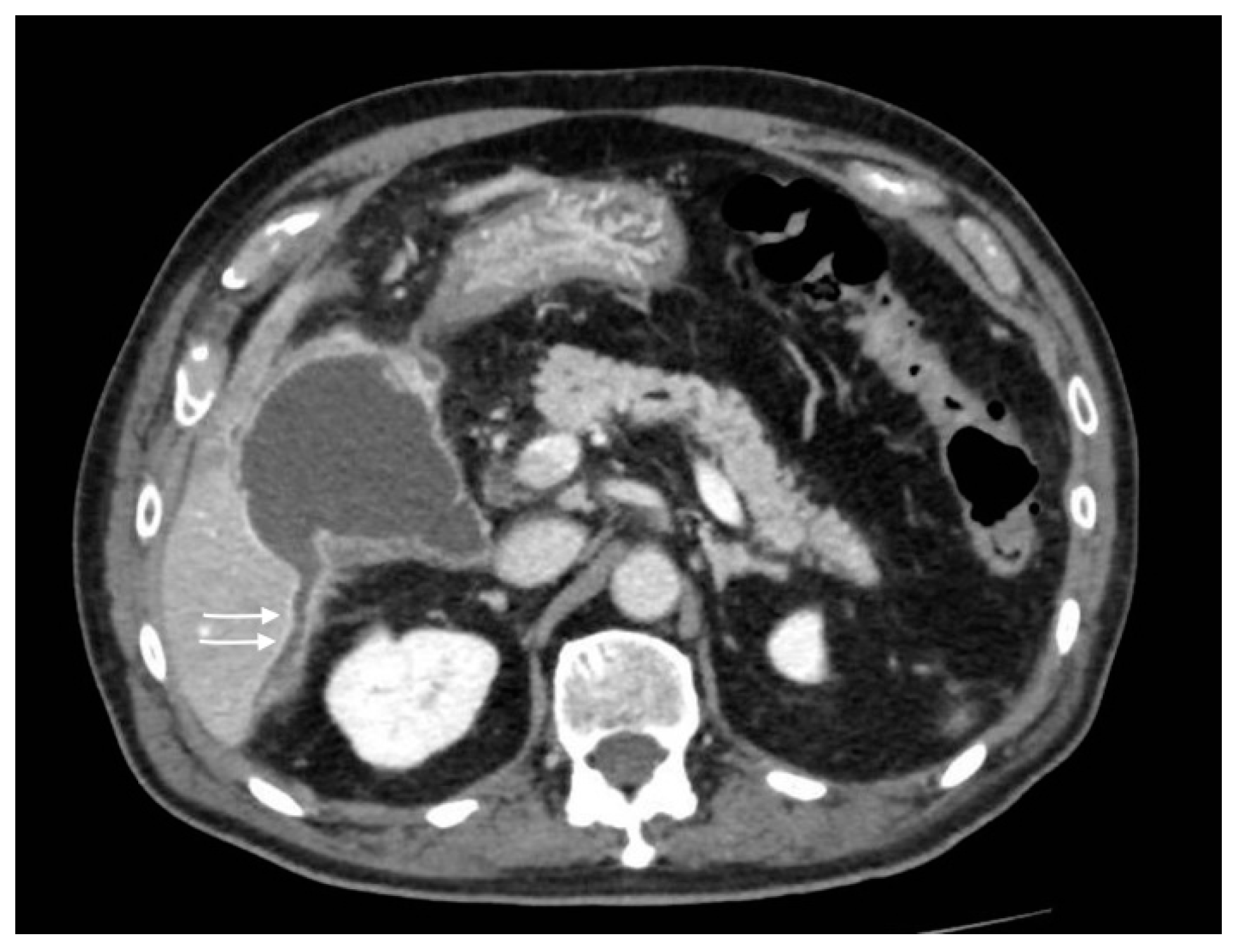 Tomography 08 00095 g005