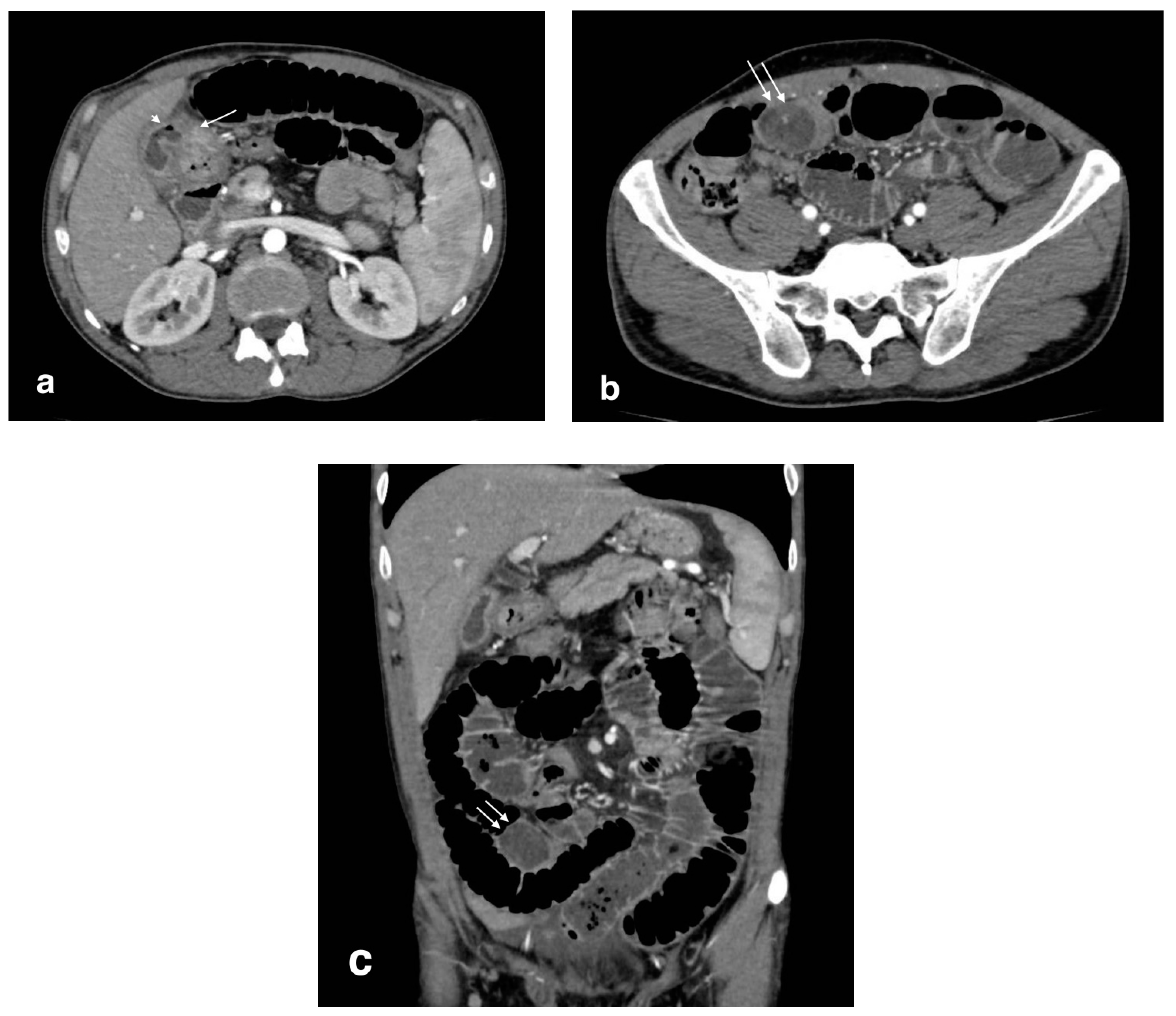 Tomography 08 00095 g006