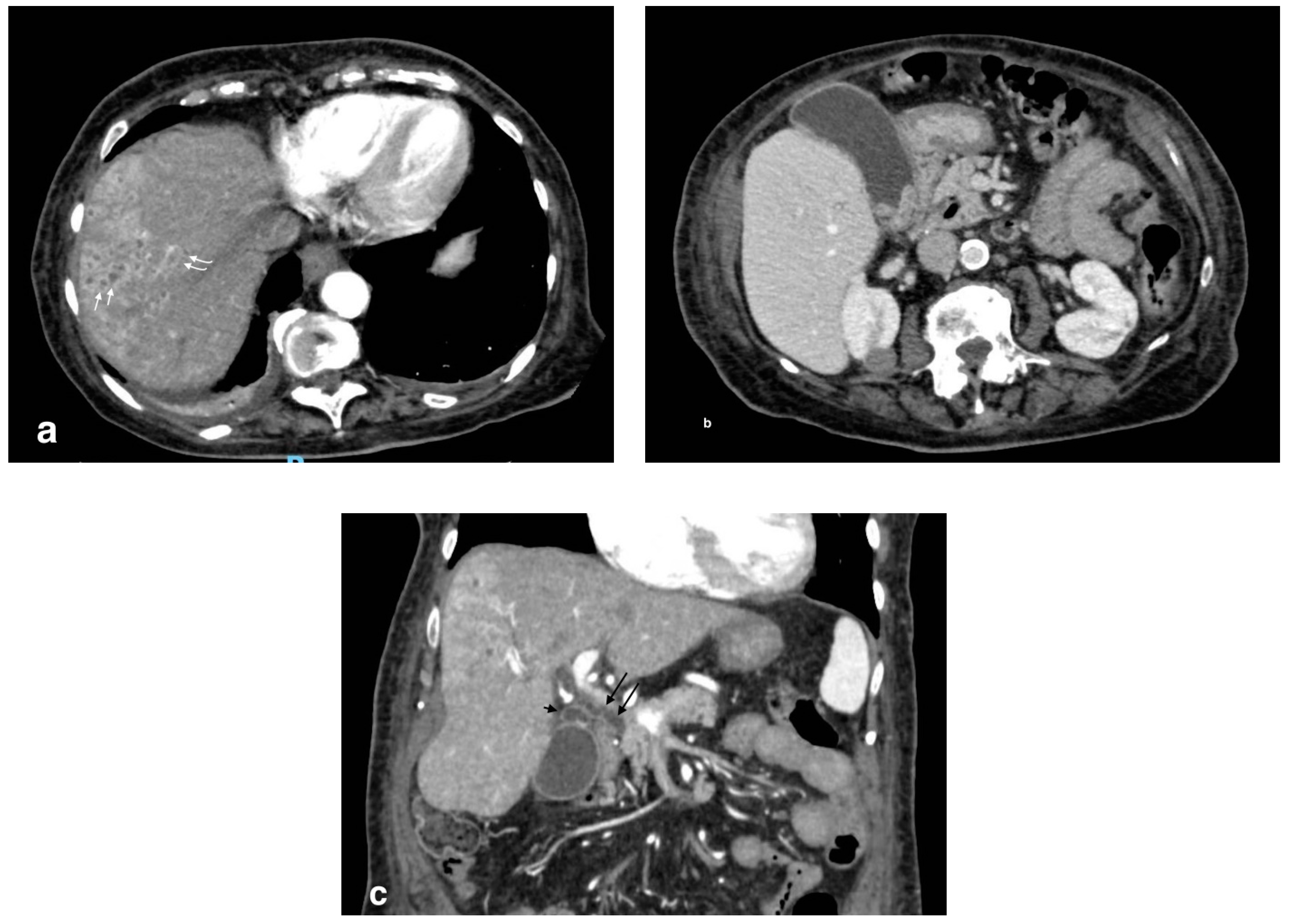 Tomography 08 00095 g007