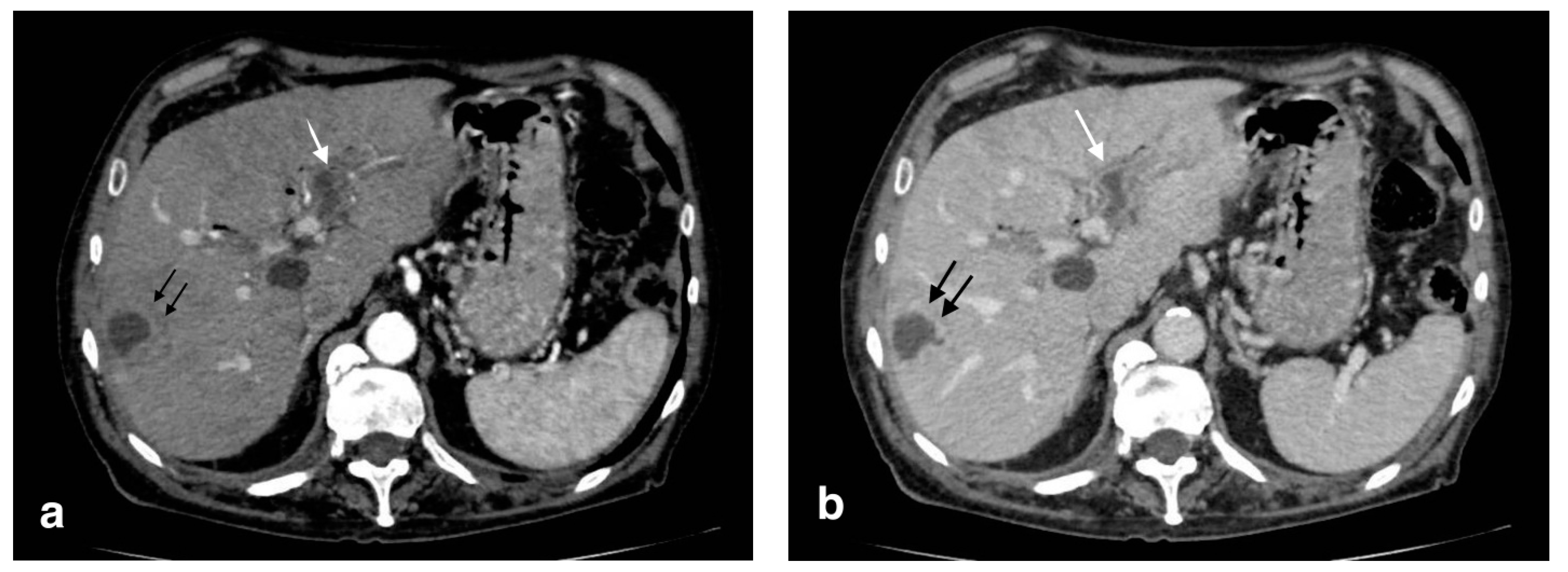 Tomography 08 00095 g009