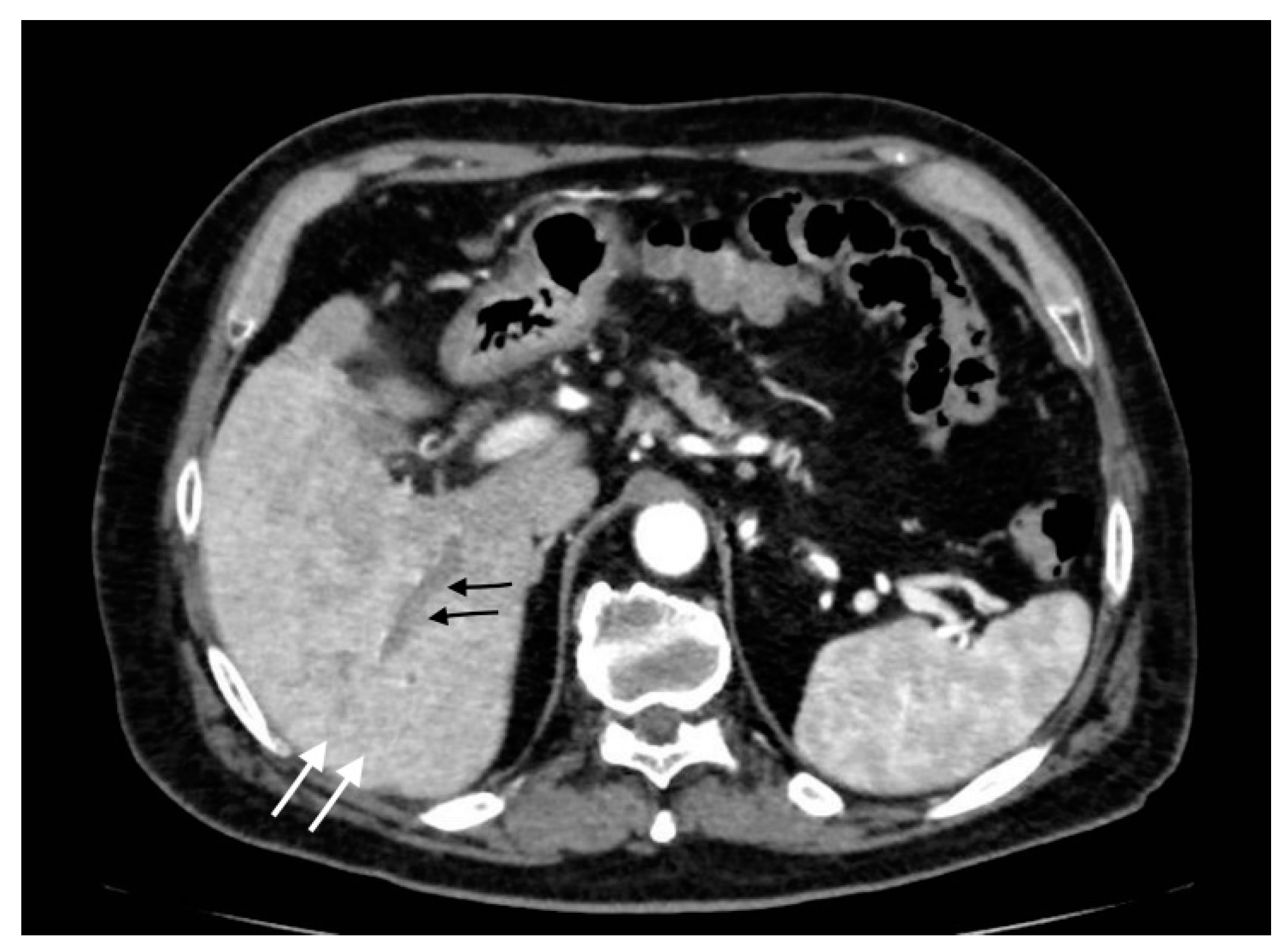 Tomography 08 00095 g010