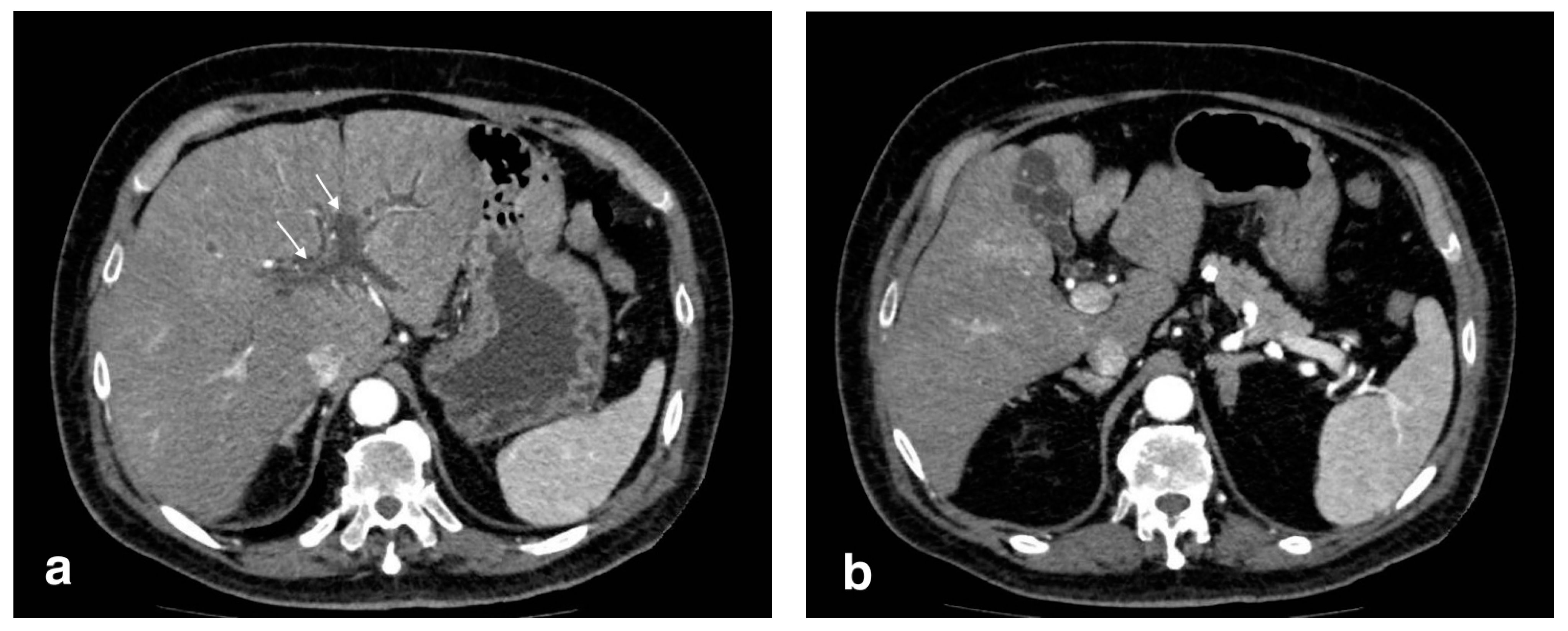 Tomography 08 00095 g011