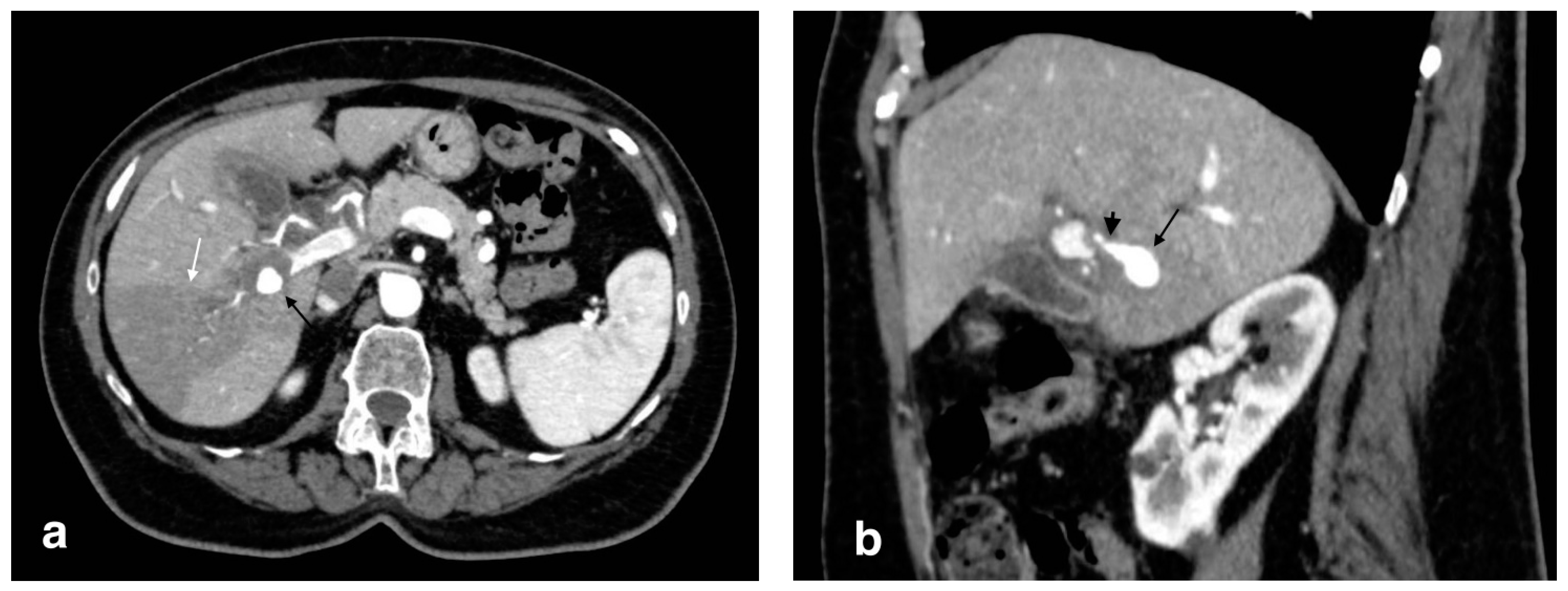 Tomography 08 00095 g012