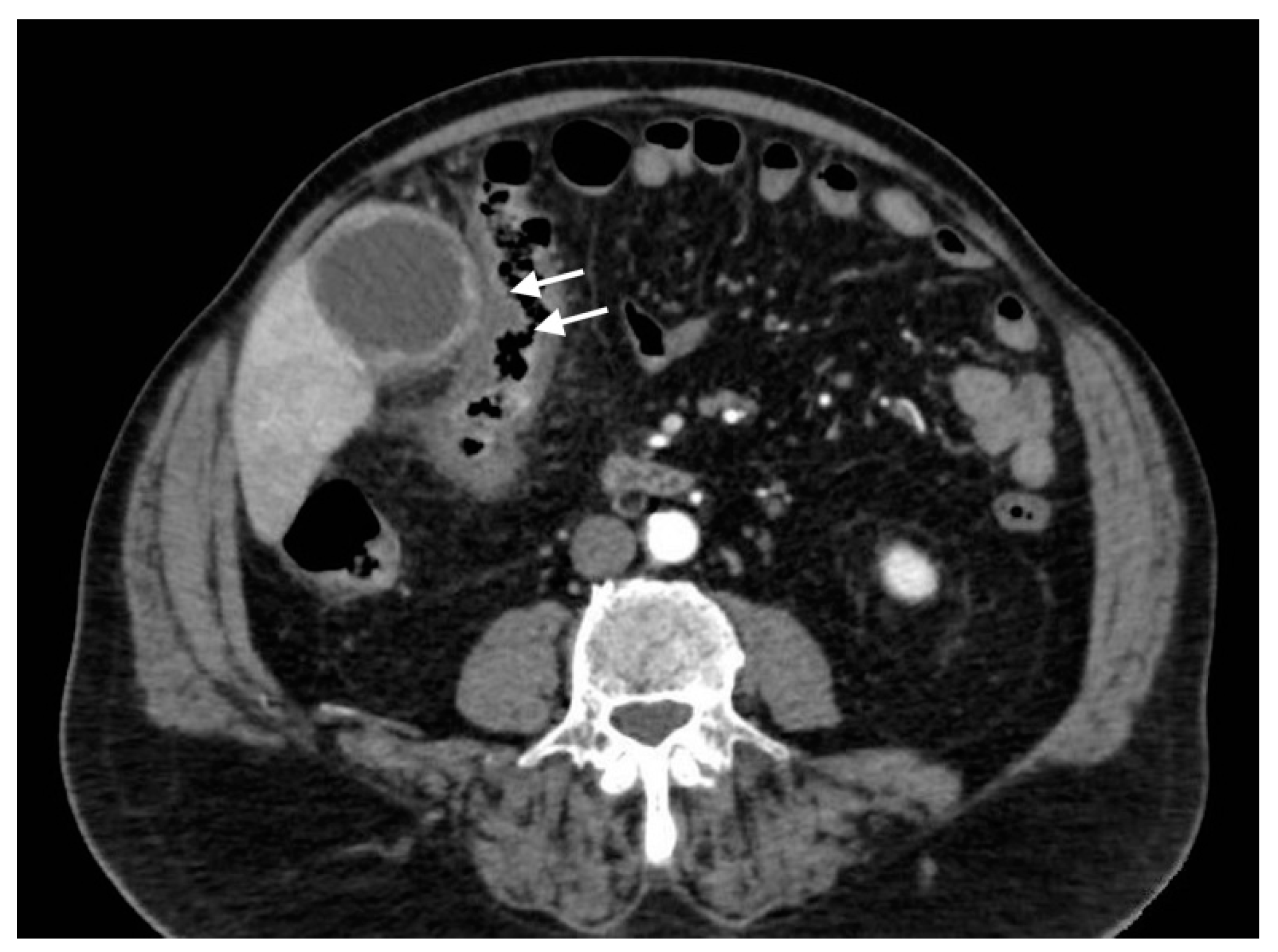 Tomography 08 00095 g013