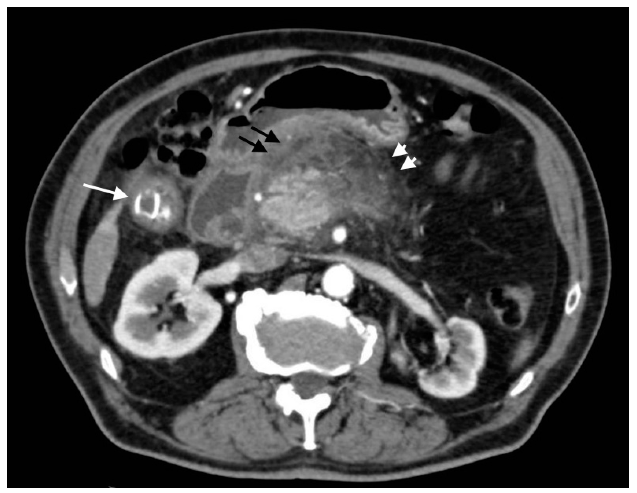 Tomography 08 00095 g014