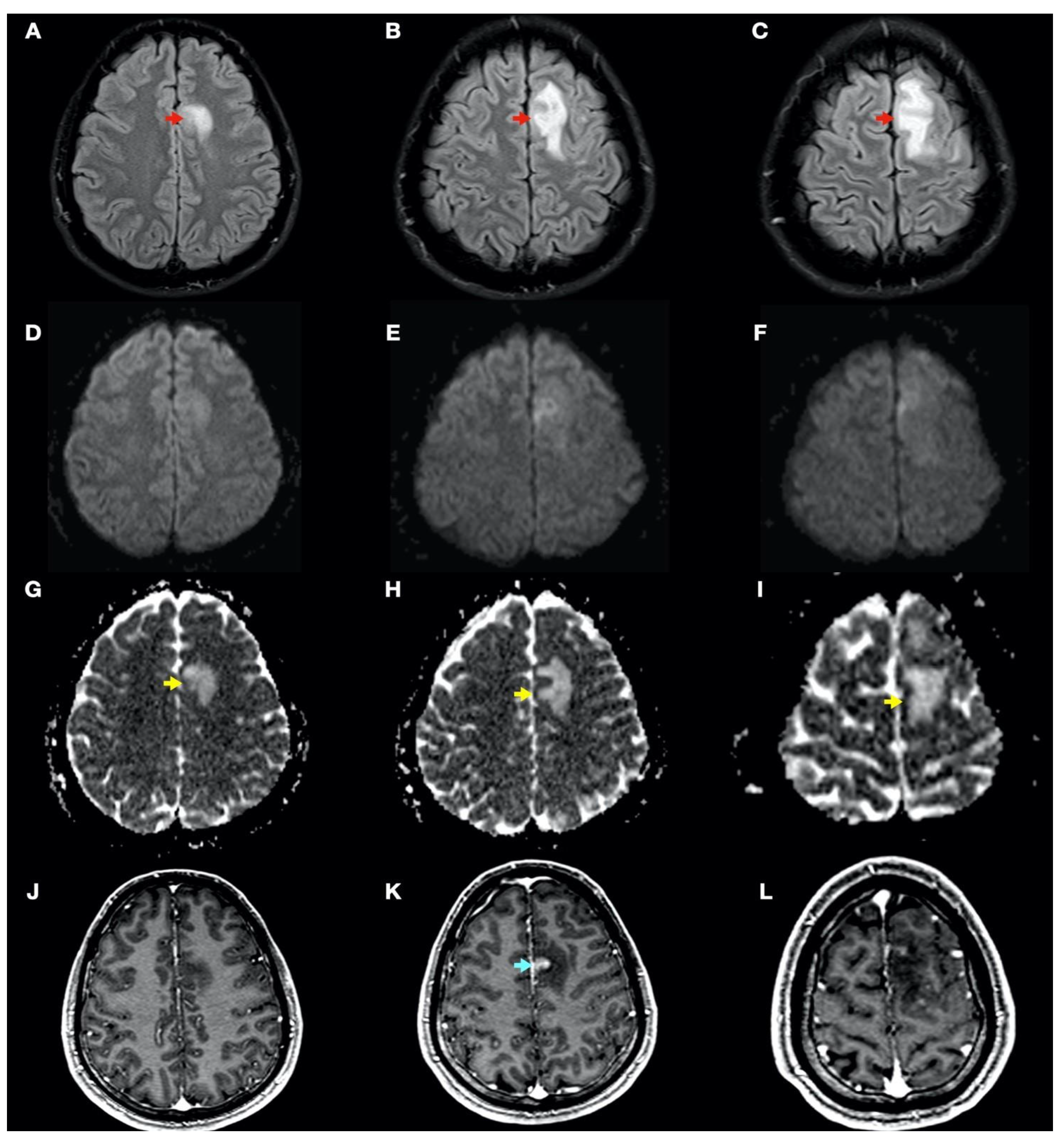 Tomography 08 00096 g003