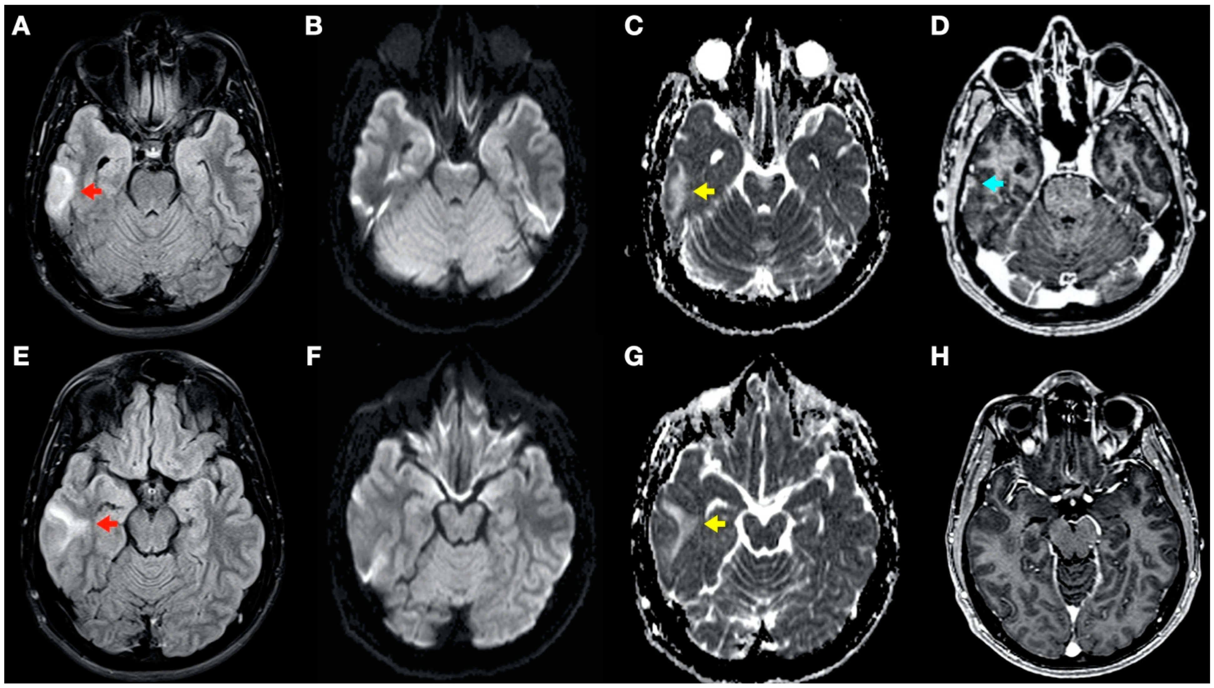 Tomography 08 00096 g004