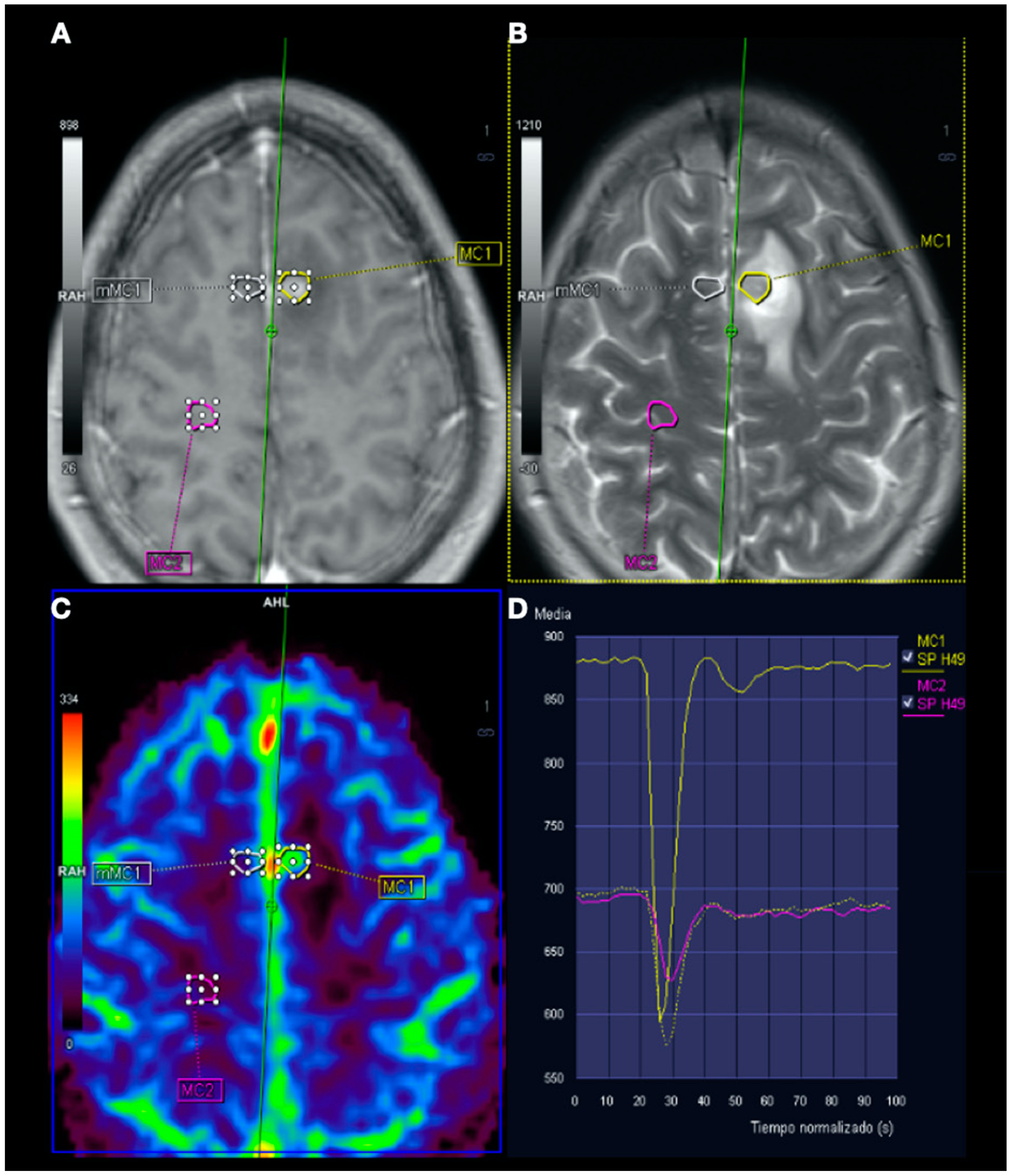 Tomography 08 00096 g005