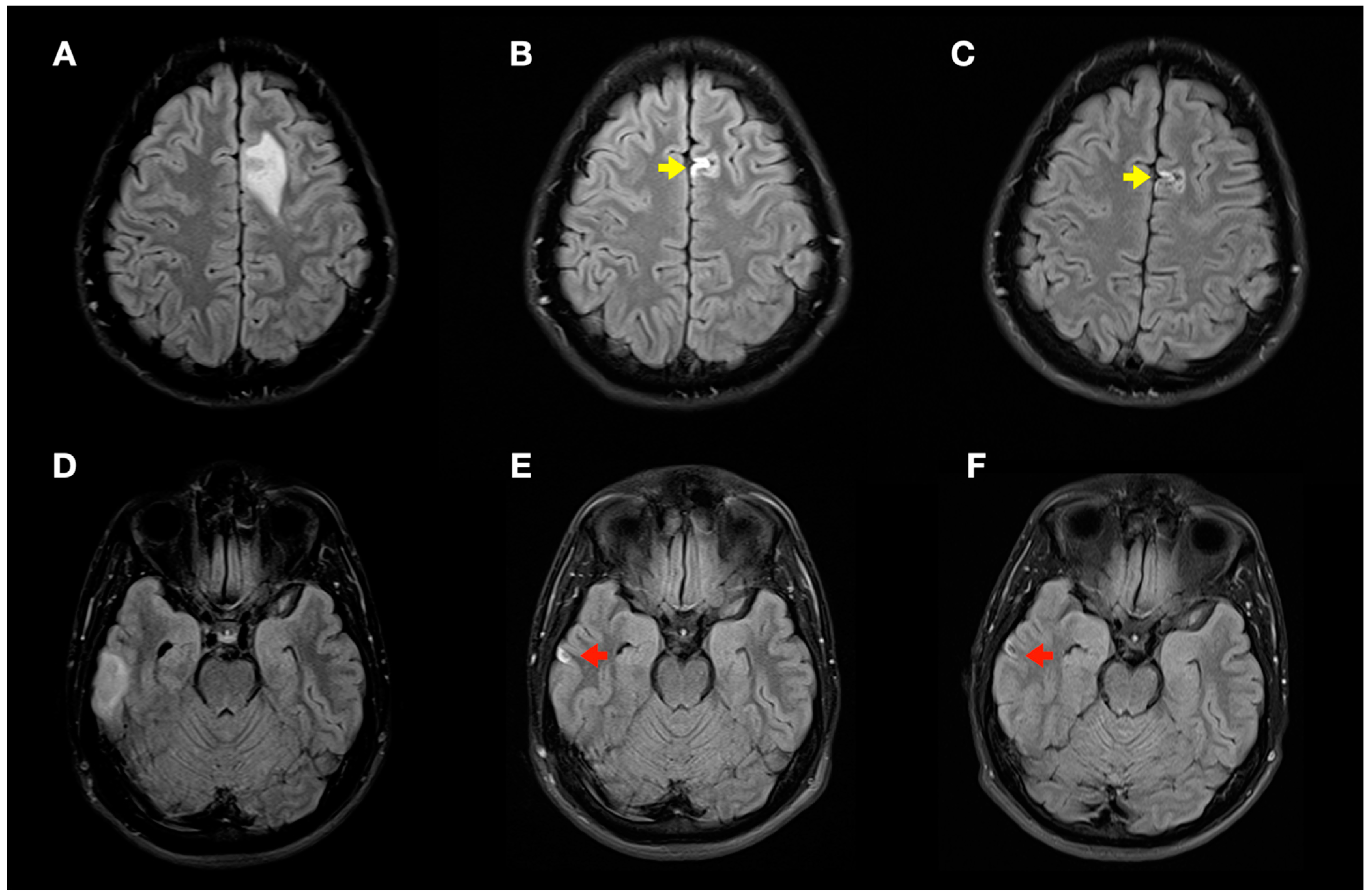 Tomography 08 00096 g006