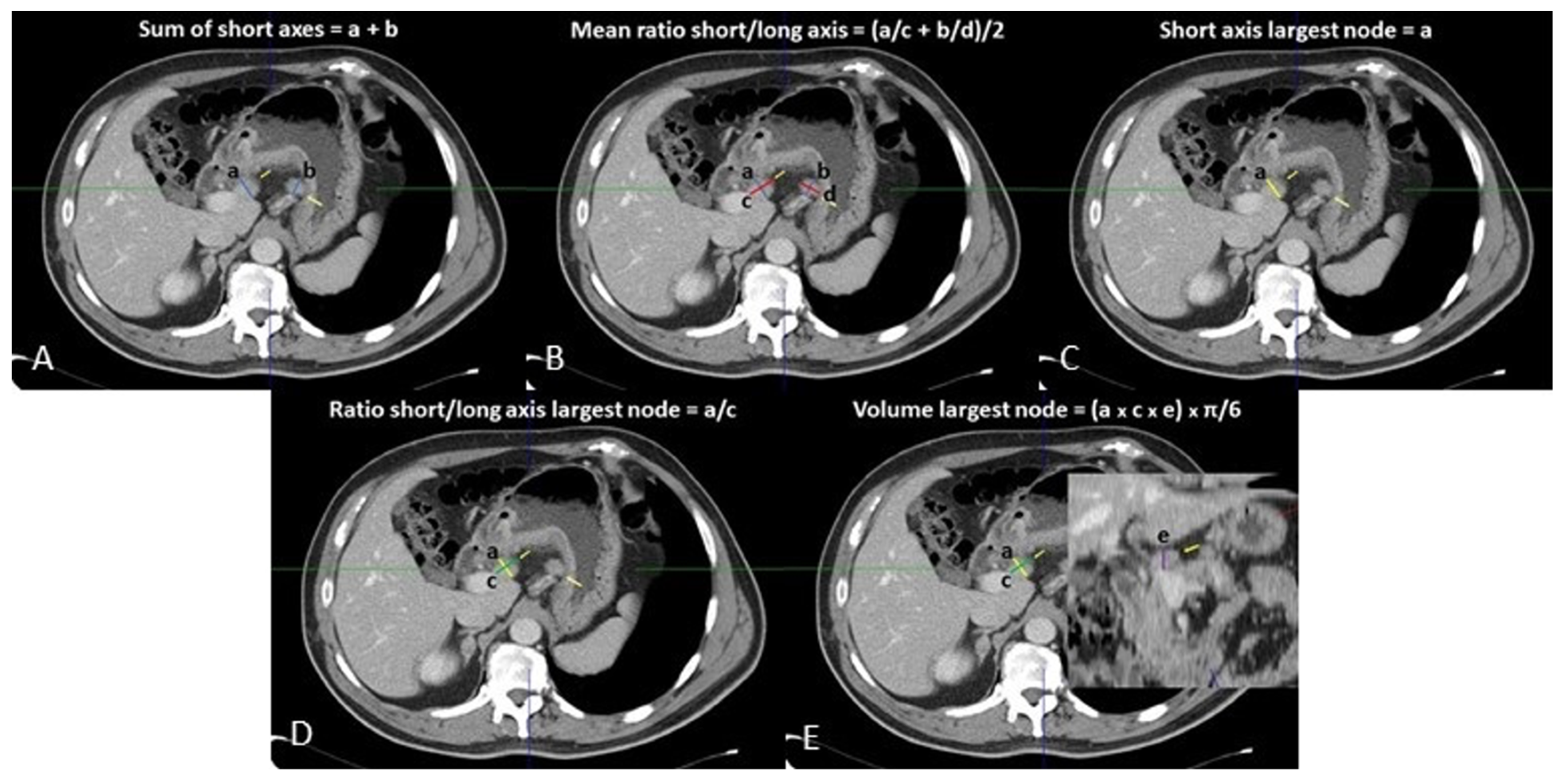 Tomography 08 00098 g001