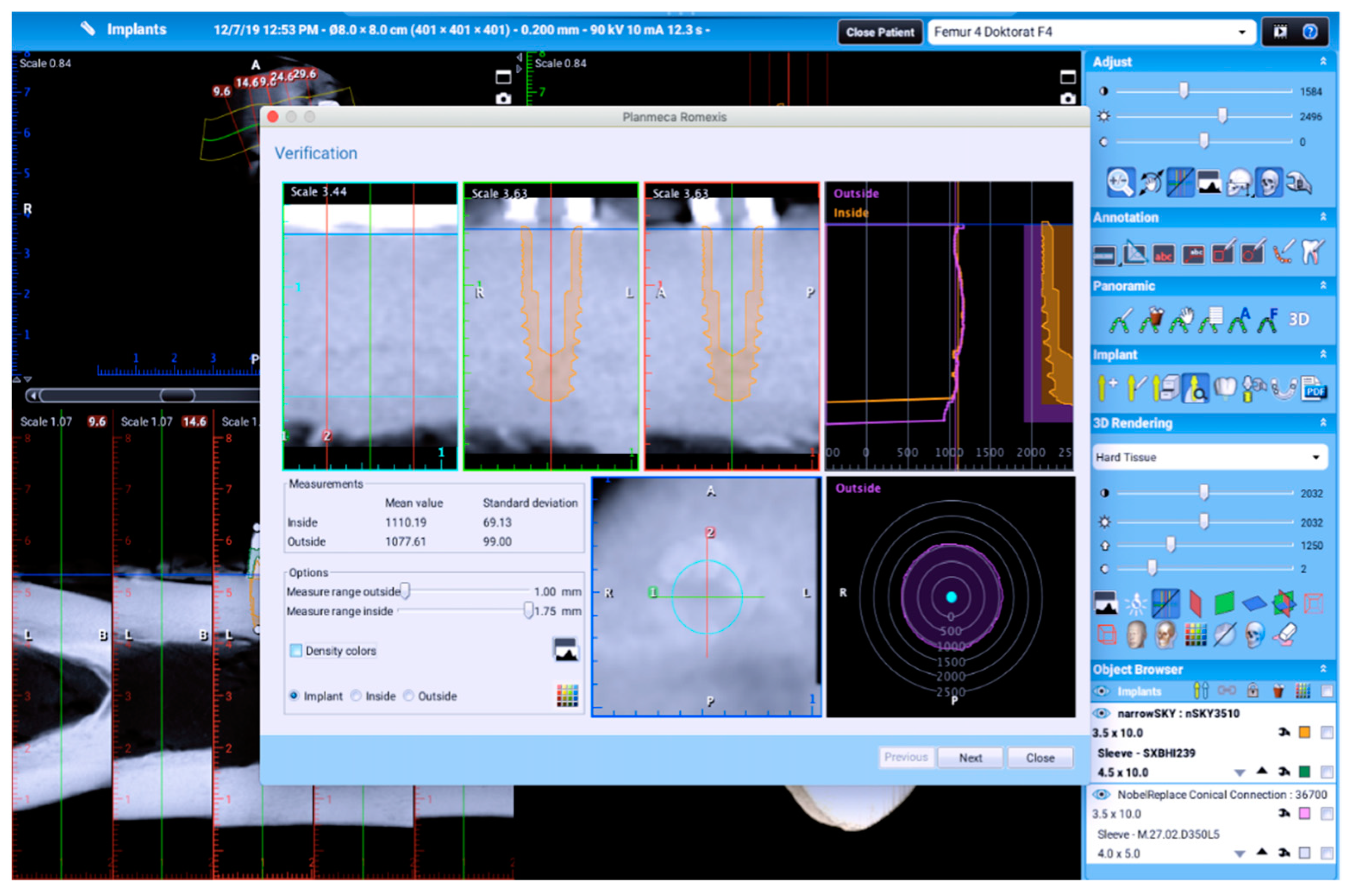 Tomography 08 00107 g002 Tomography 08 00107 g002