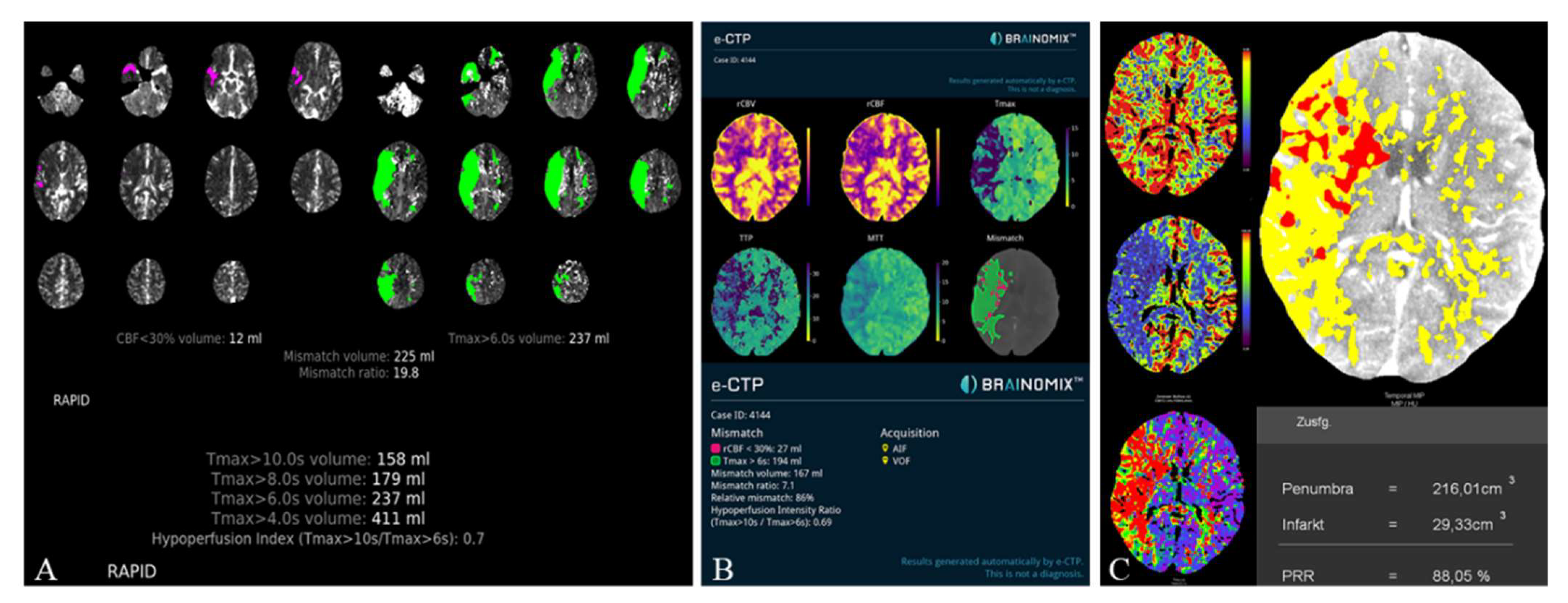 Tomography 08 00109 g003