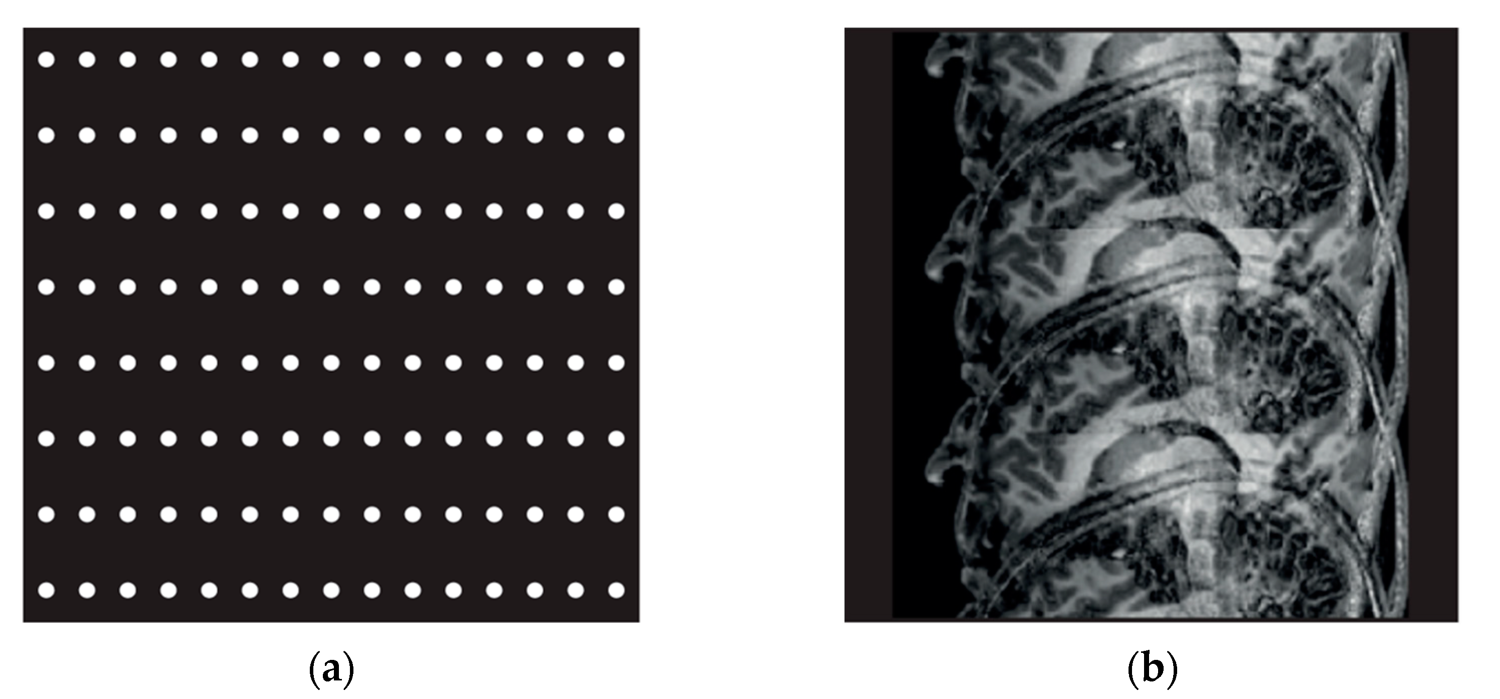 Tomography 08 00111 g001 Tomography 08 00111 g001
