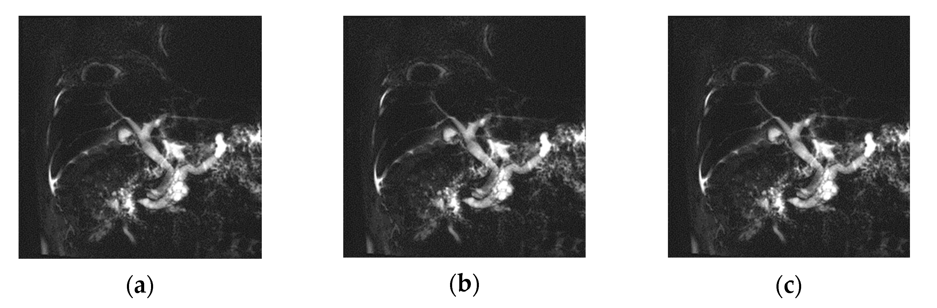 Tomography 08 00111 g008 Tomography 08 00111 g008