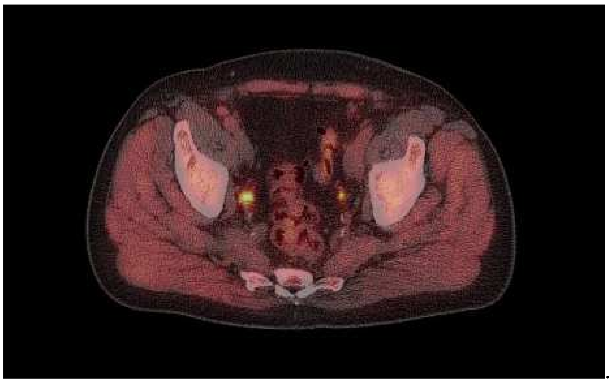 Tomography 08 00120 g001