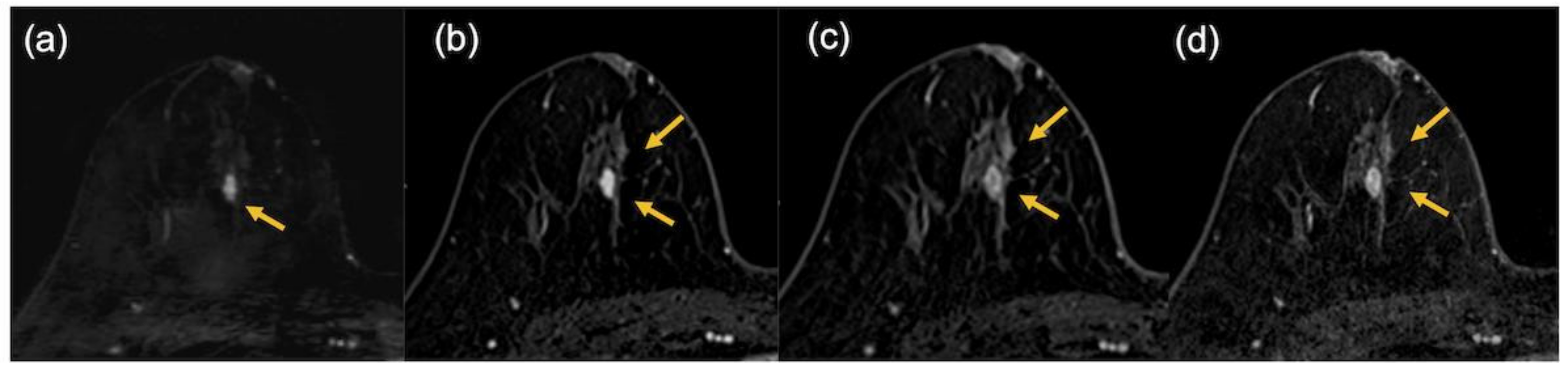 Tomography 08 00125 g008