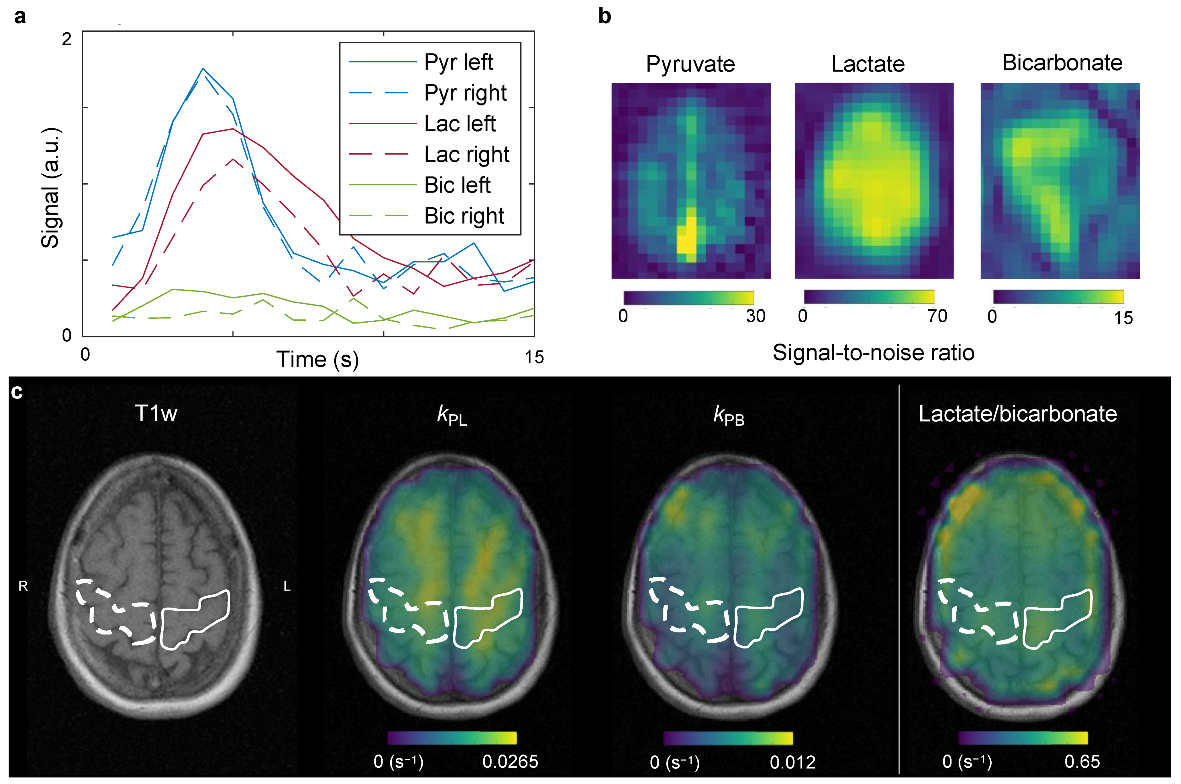 Tomography 08 00129 g003