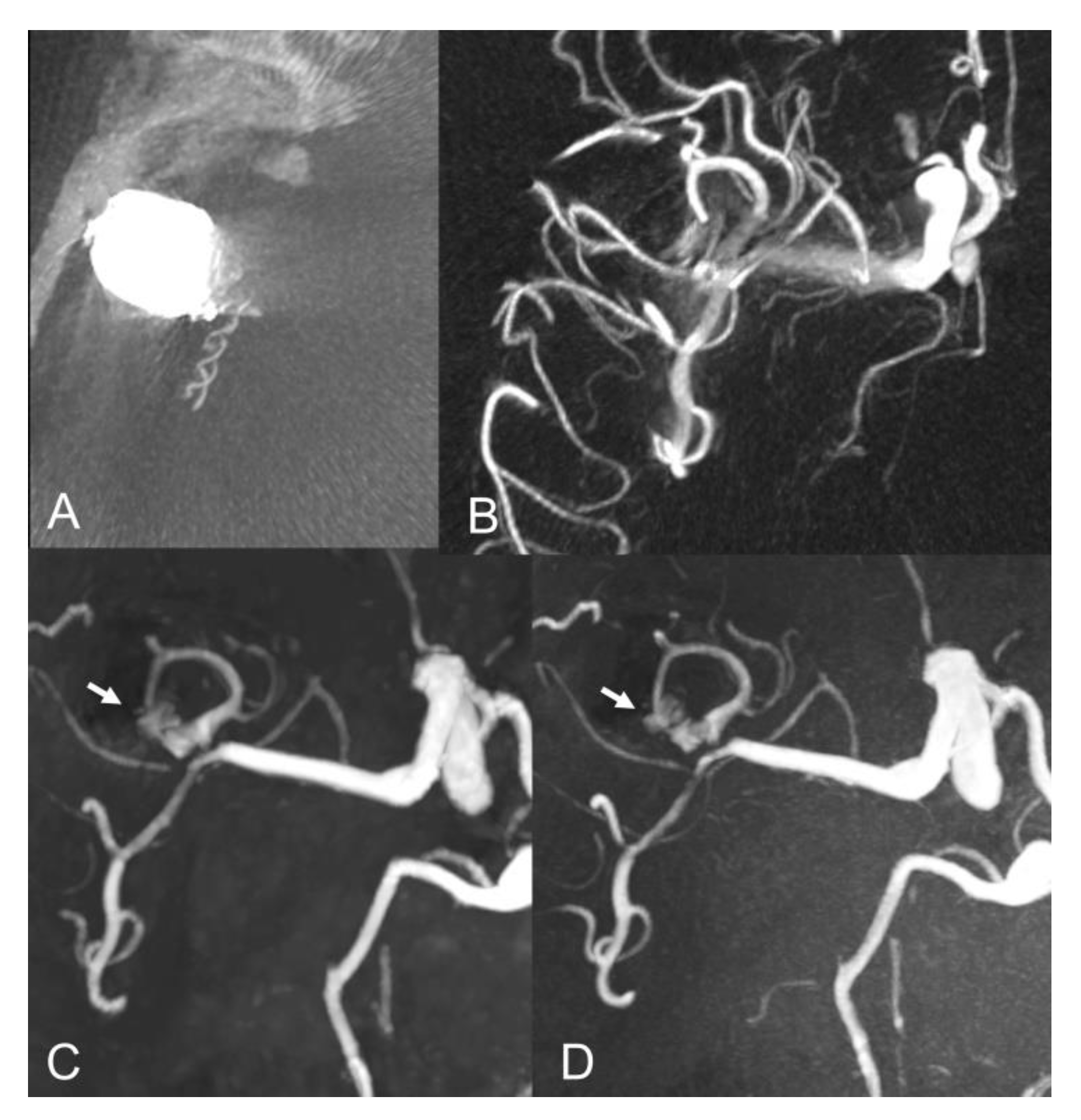 Tomography 08 00133 g003